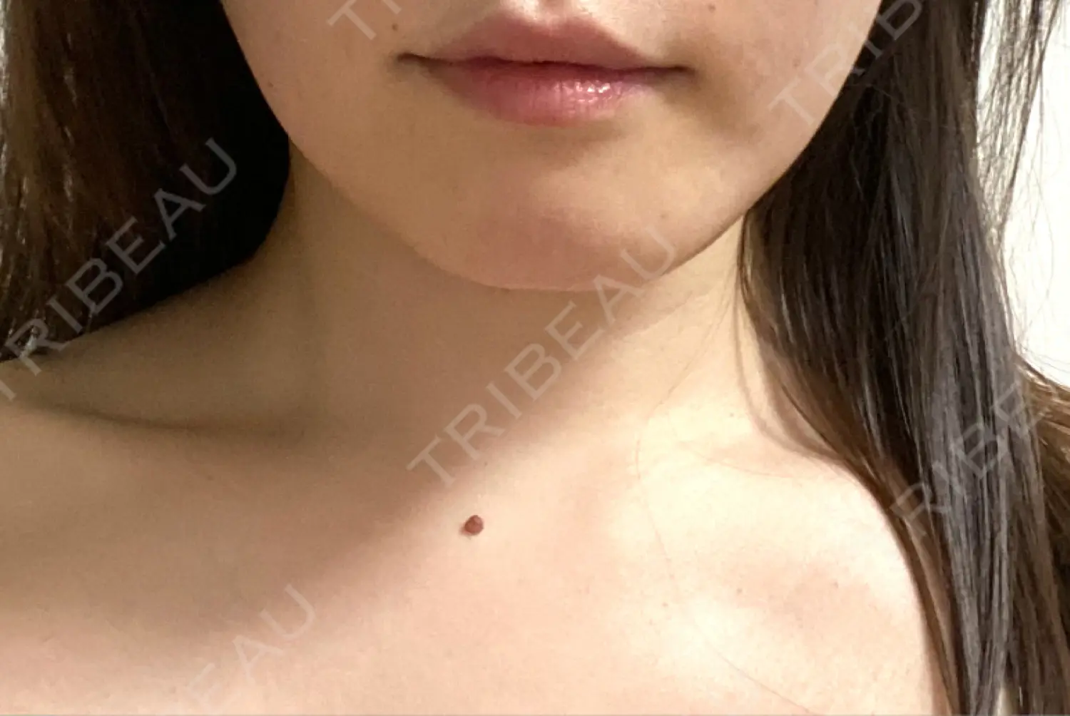 施術前の写真