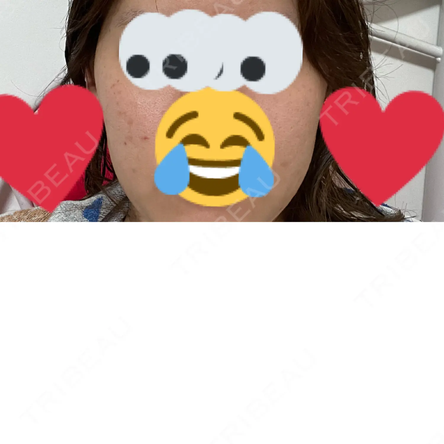 施術前の写真