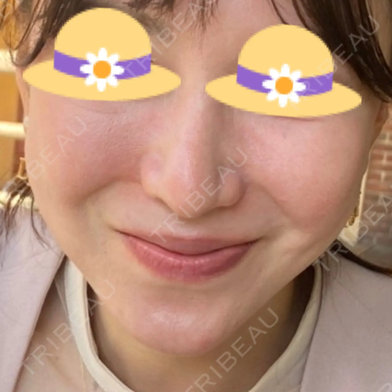 施術前の写真