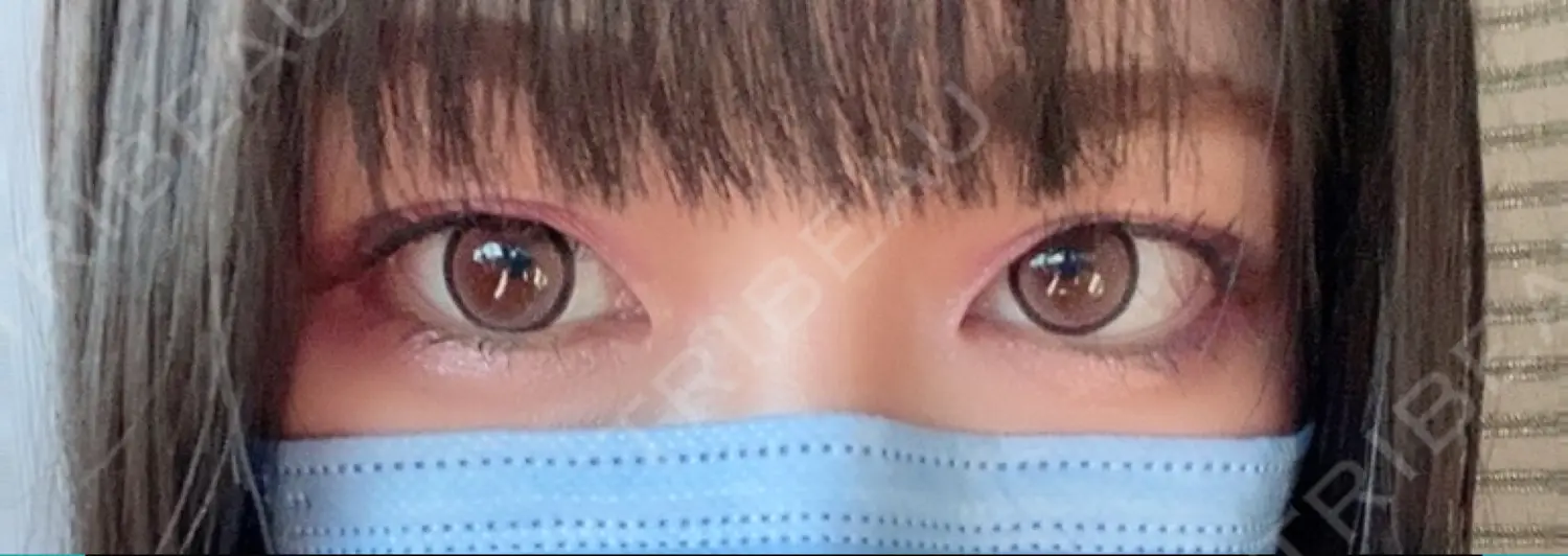 施術前の写真