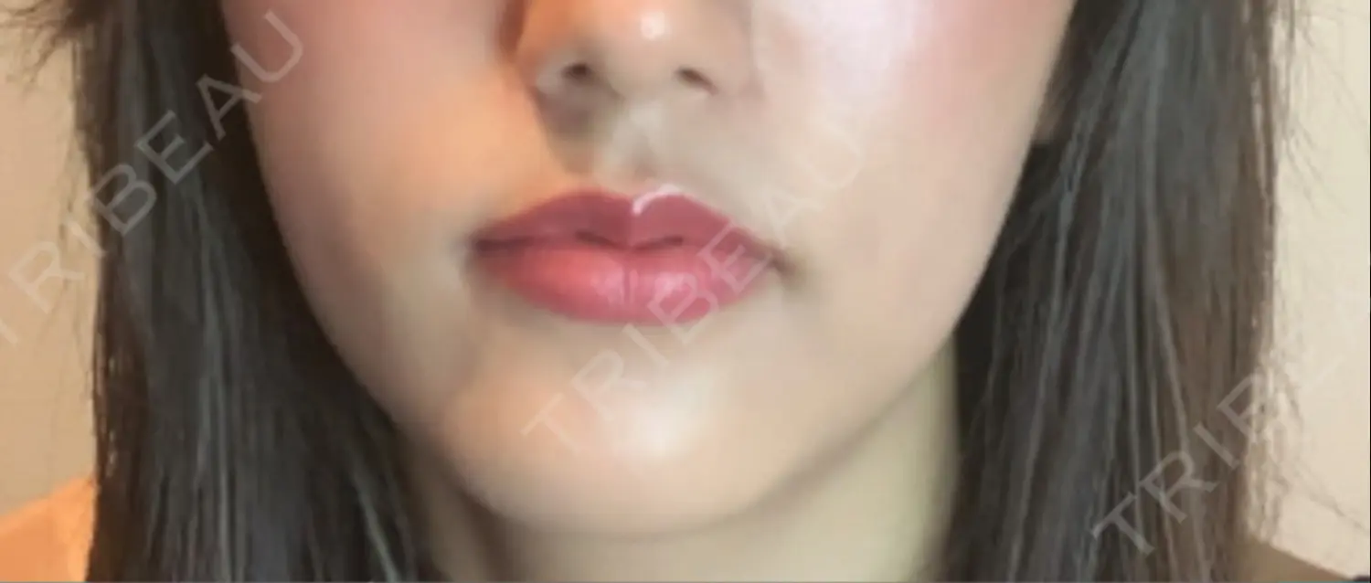 施術前の写真