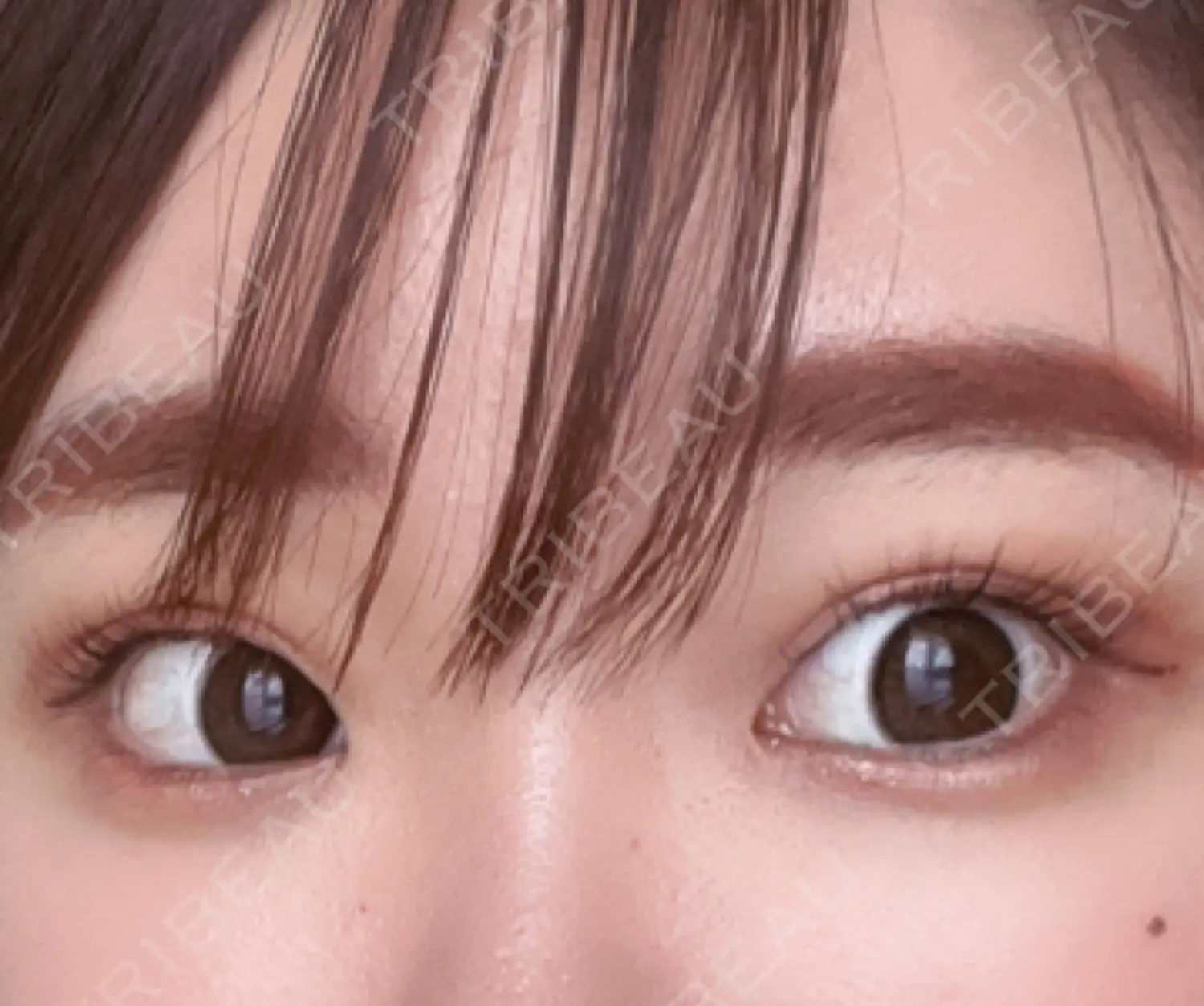 施術前の写真