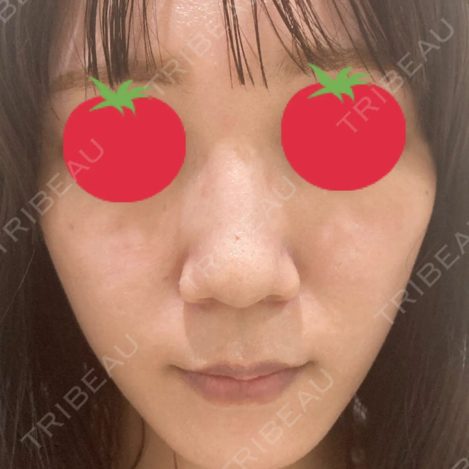 施術前の写真