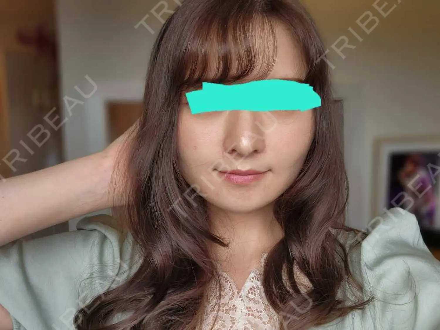施術前の写真