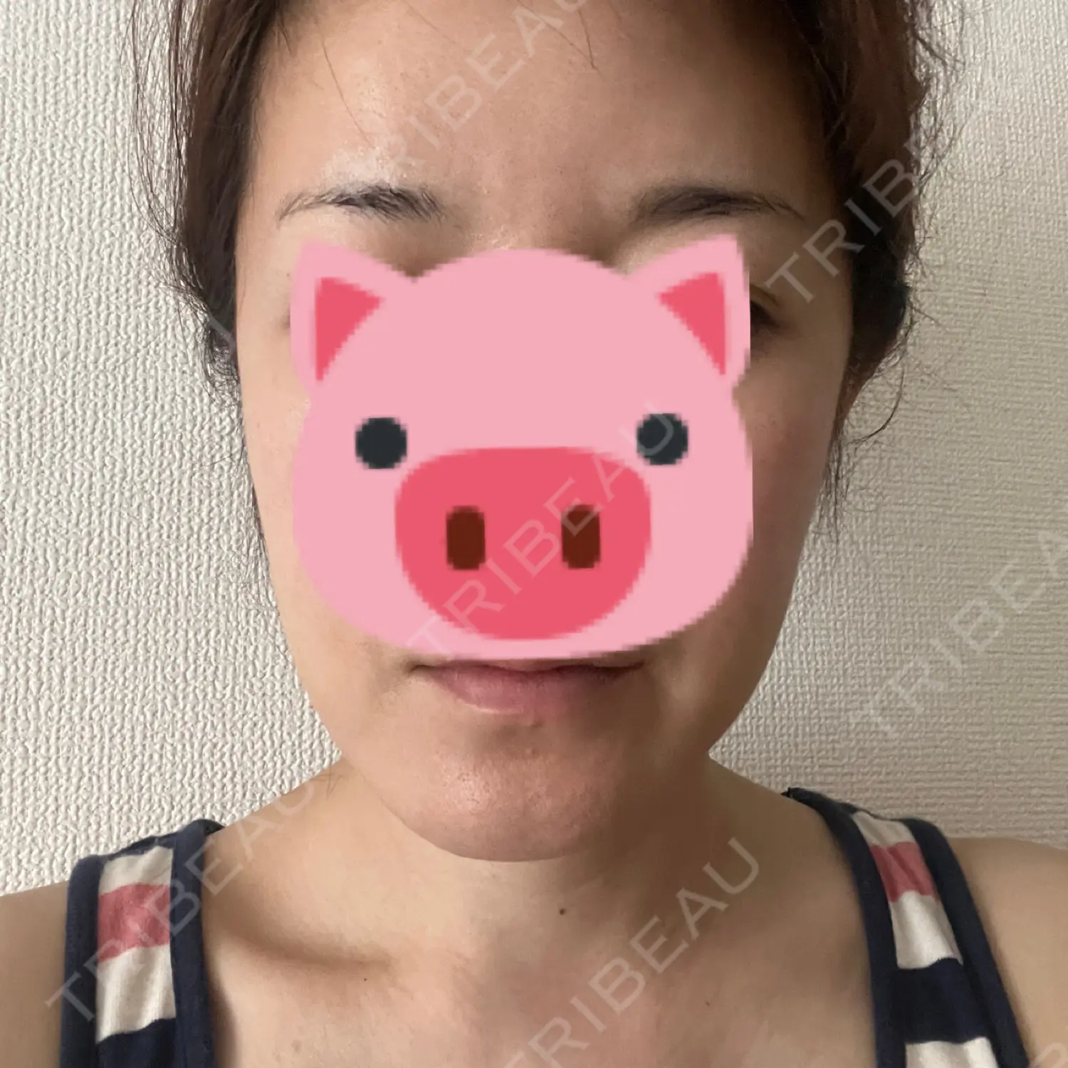 施術前の写真