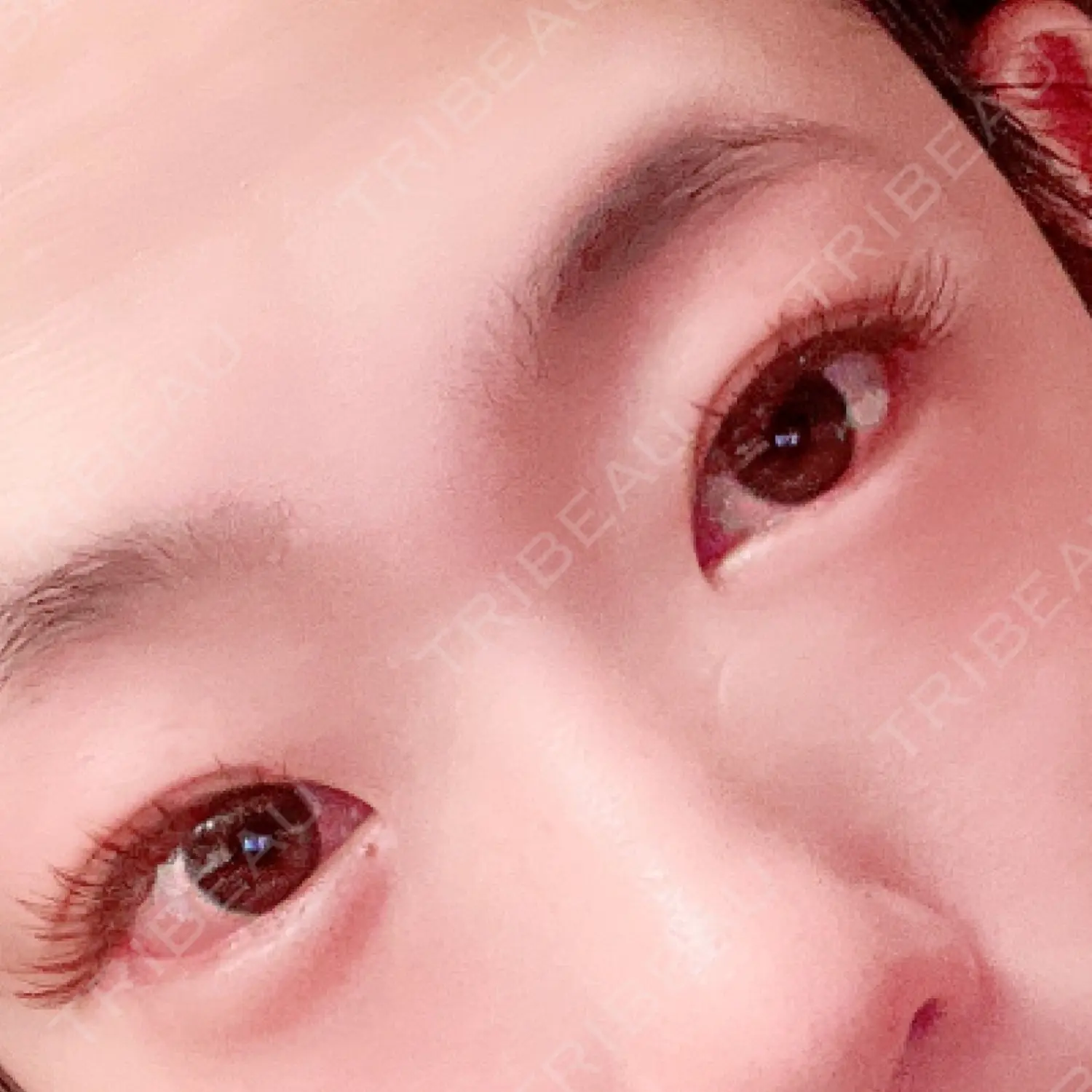 施術前の写真