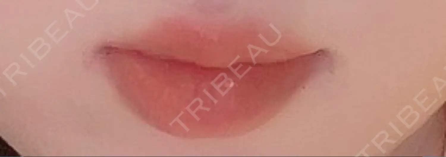 施術前の写真