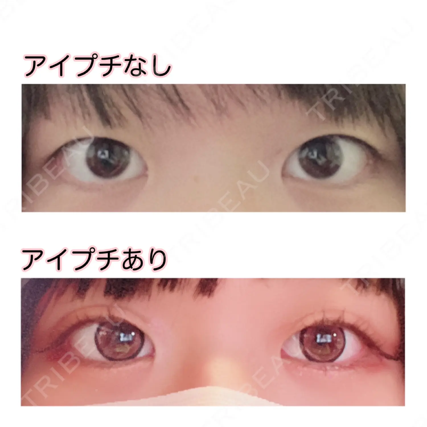 施術前の写真
