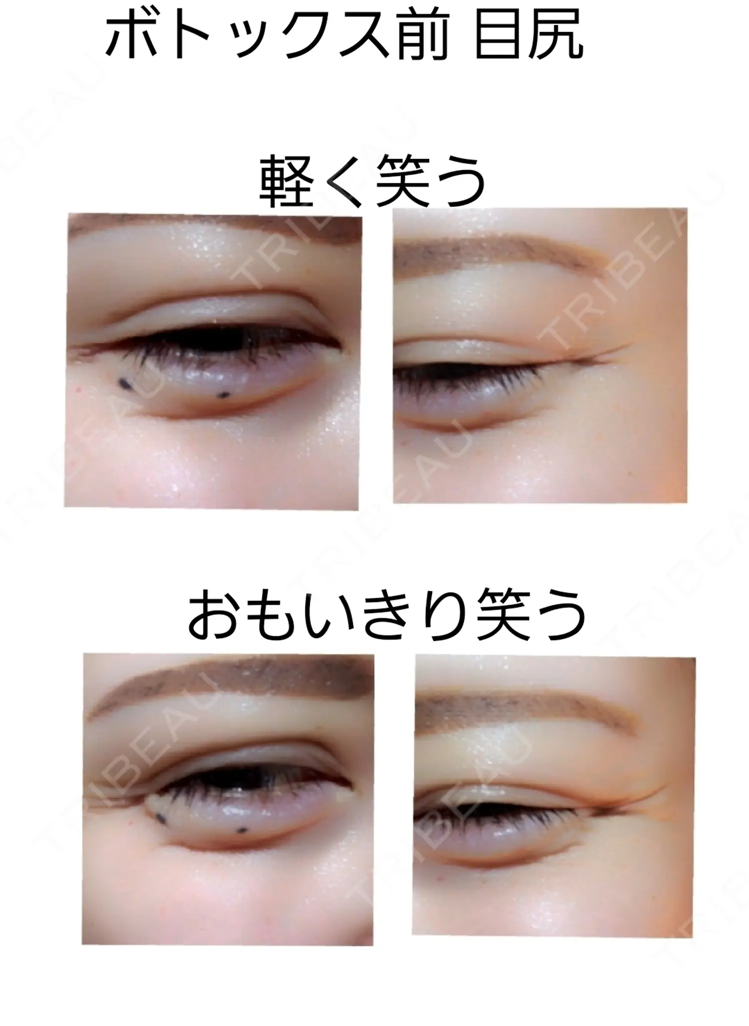 施術前の写真