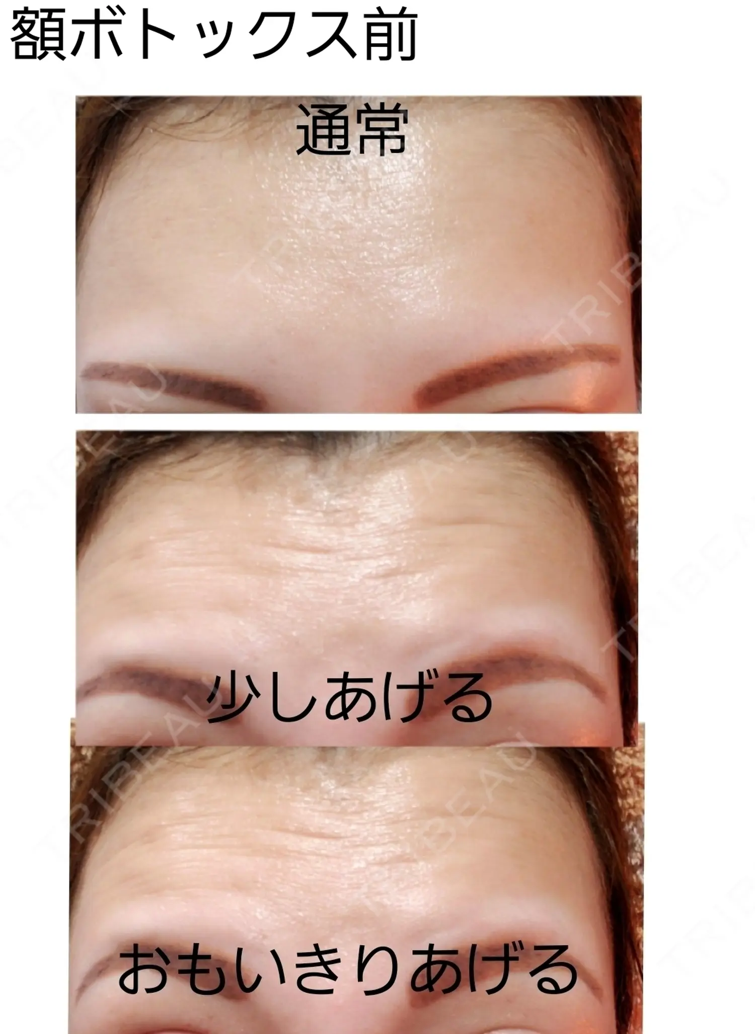 施術前の写真