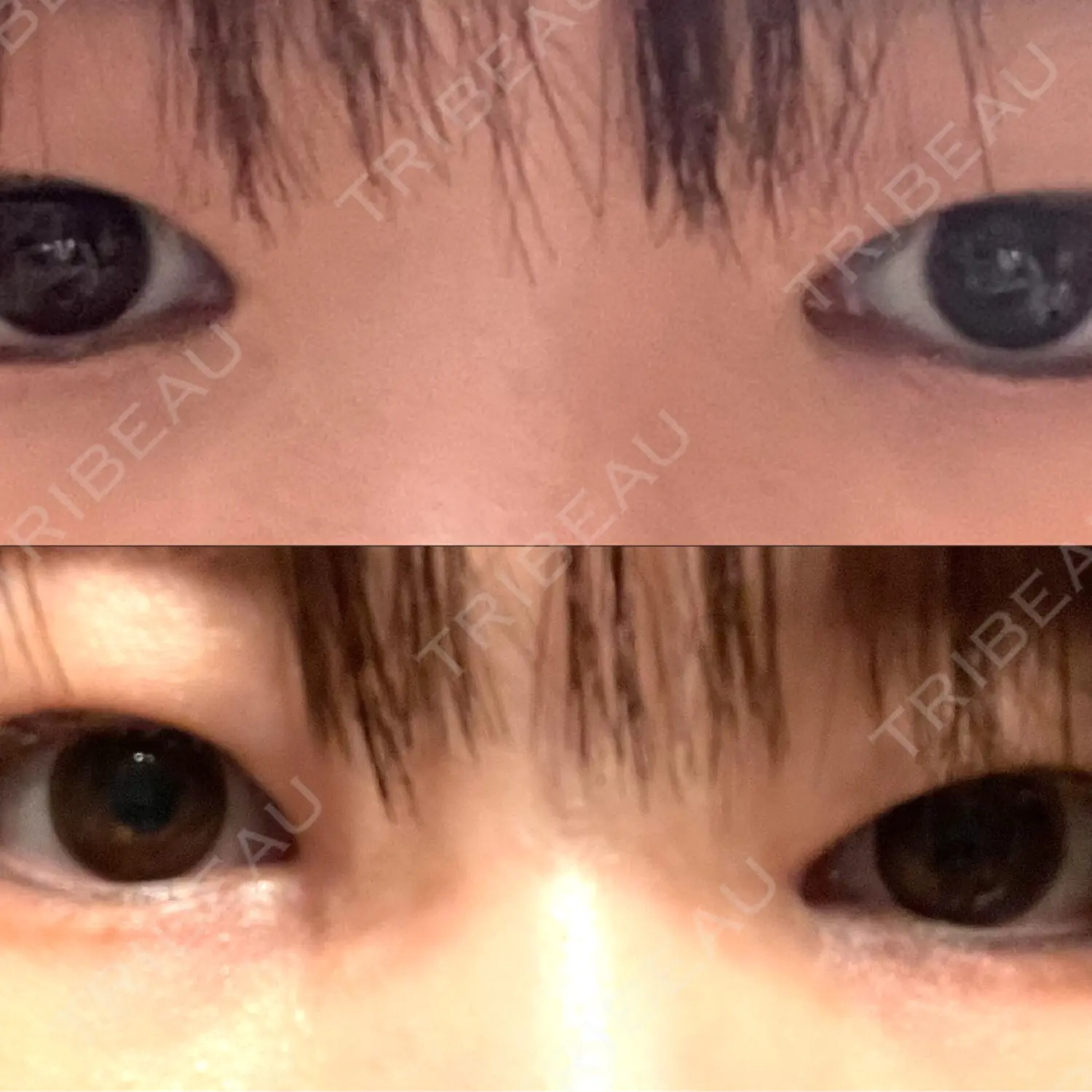 施術前の写真