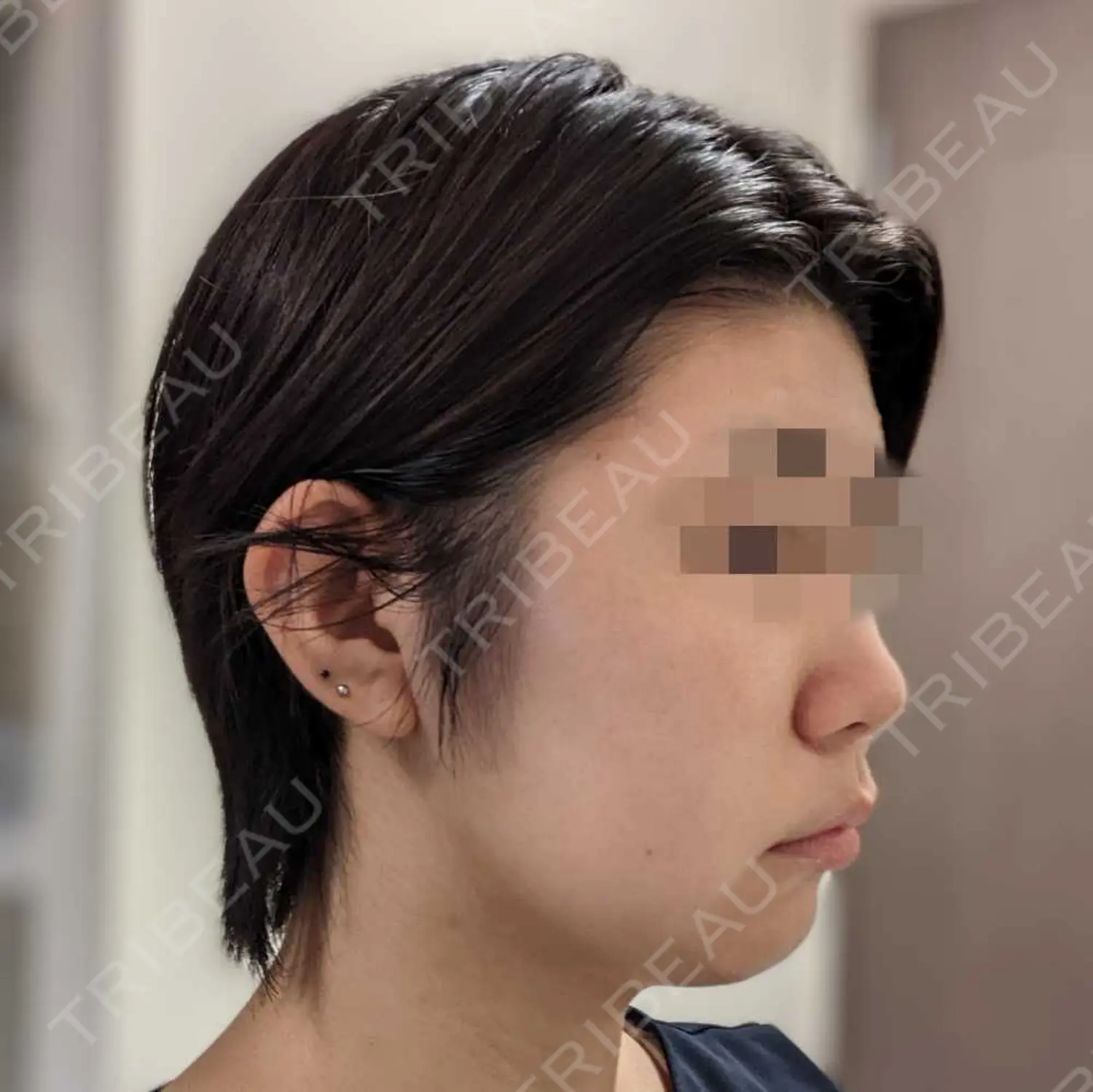 施術前の写真