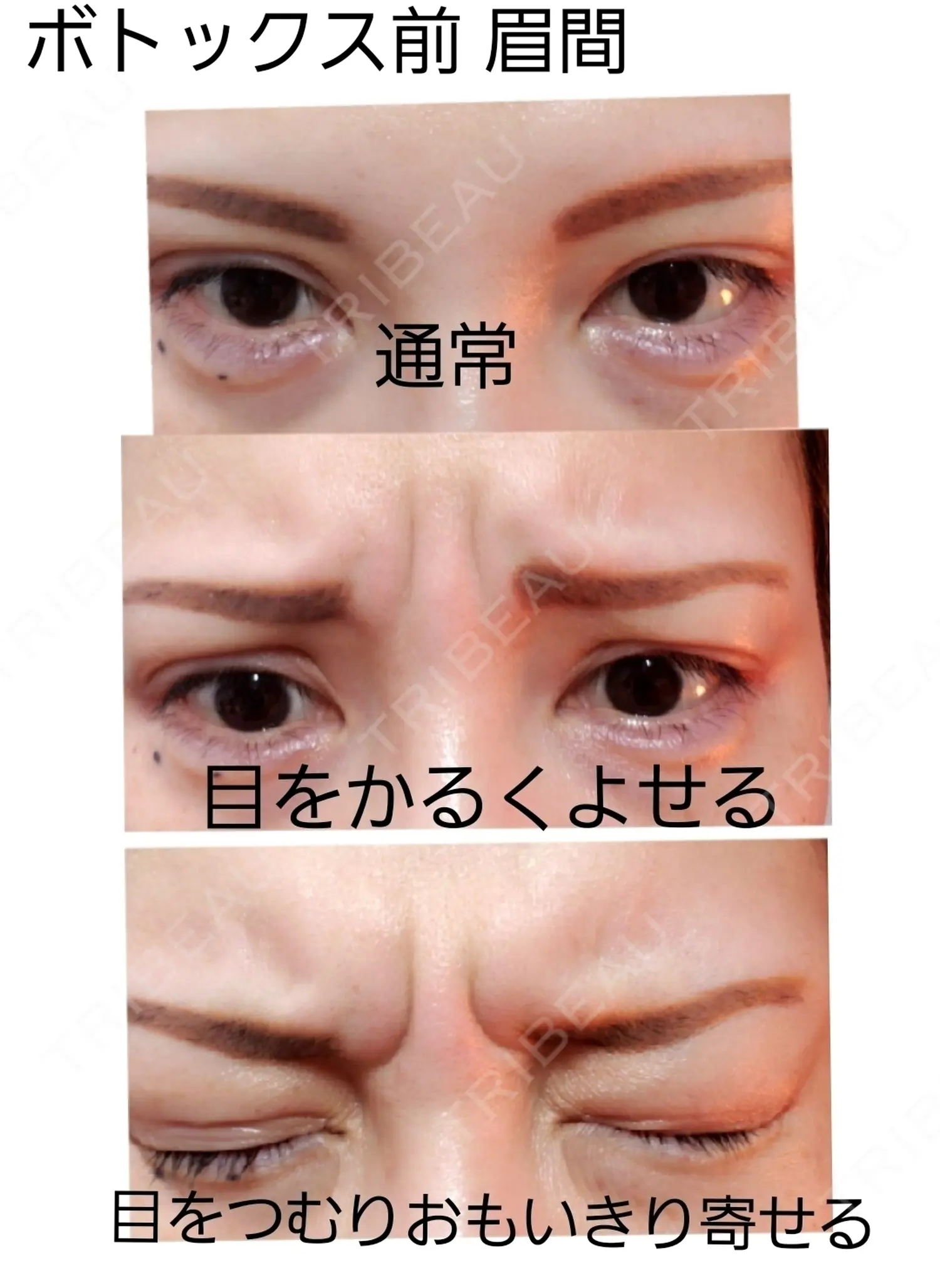 施術前の写真