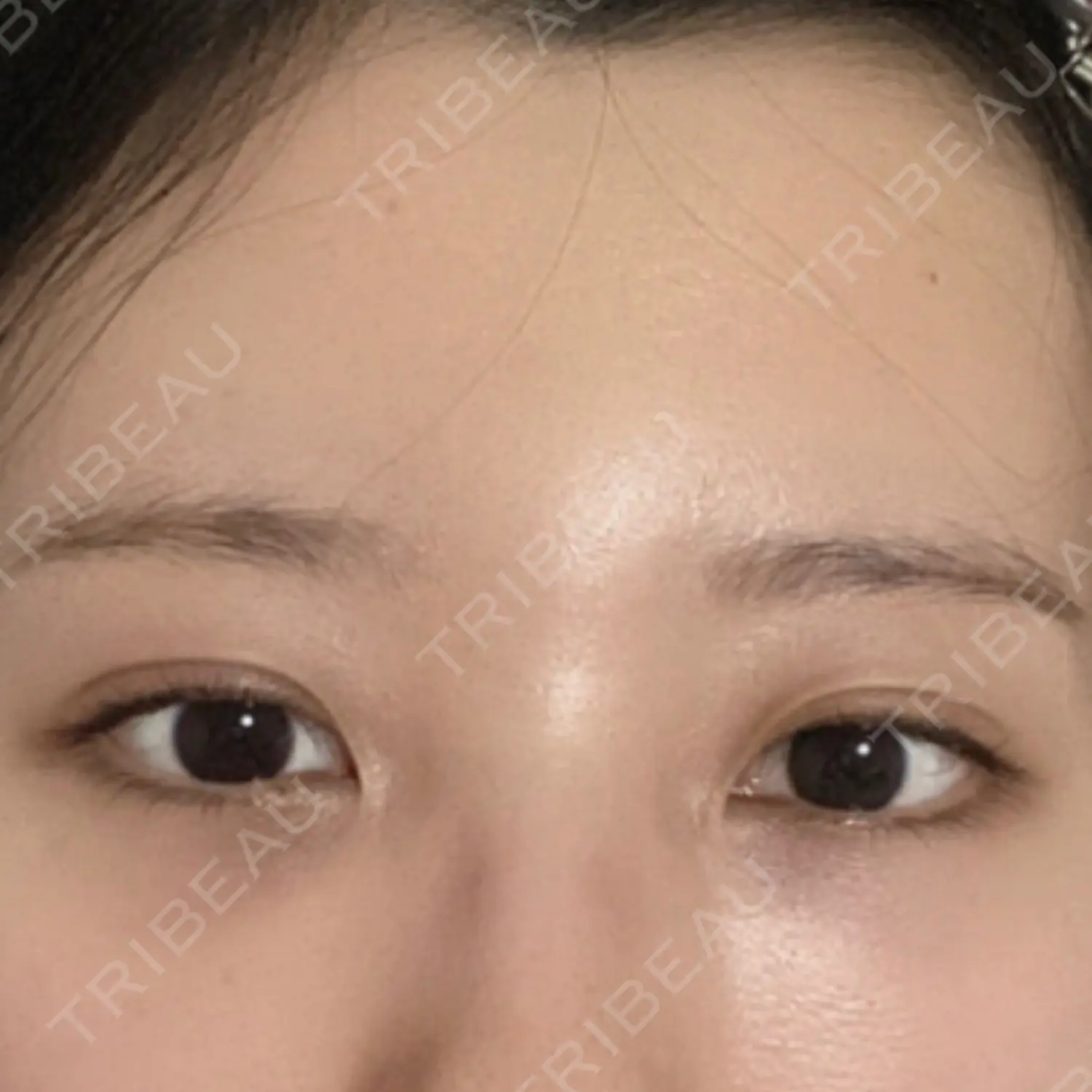 施術前の写真
