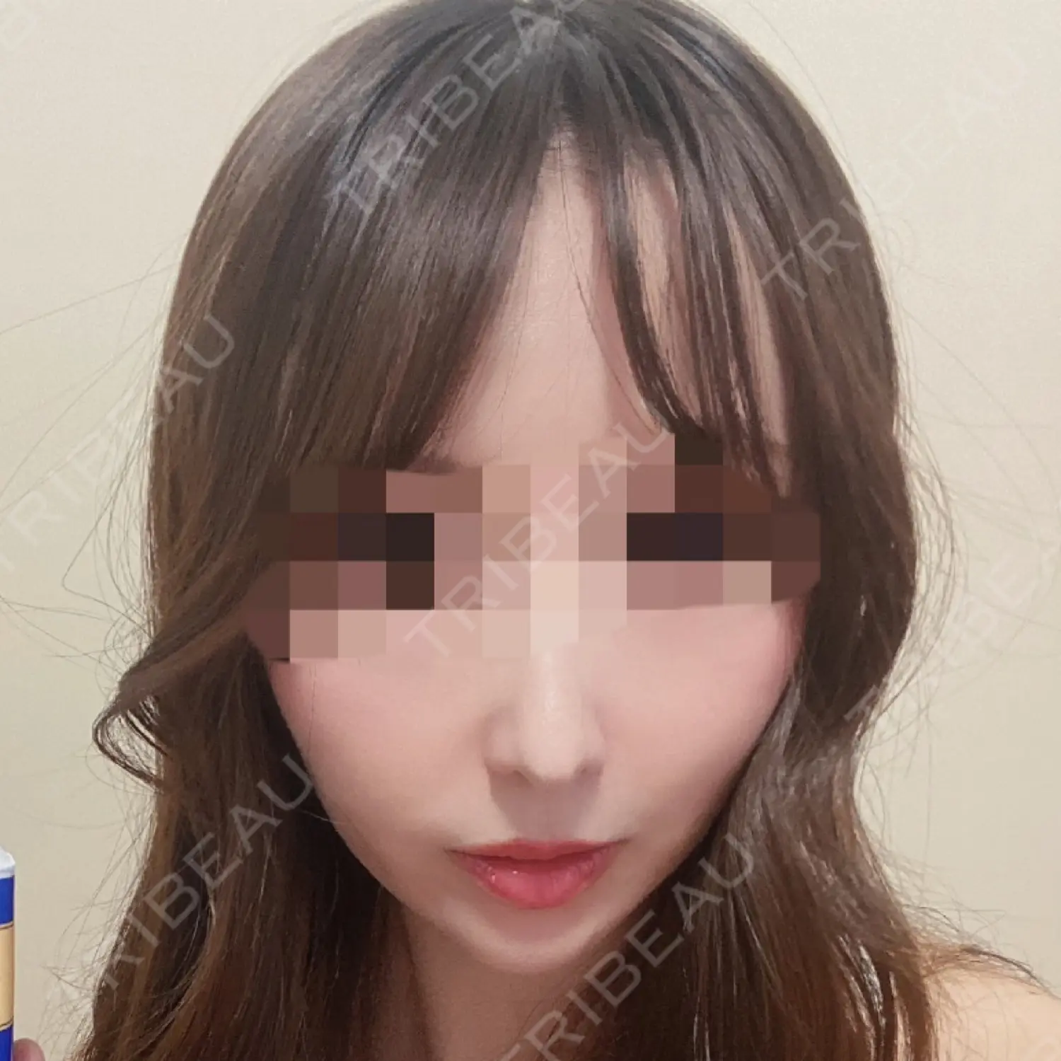 施術前の写真