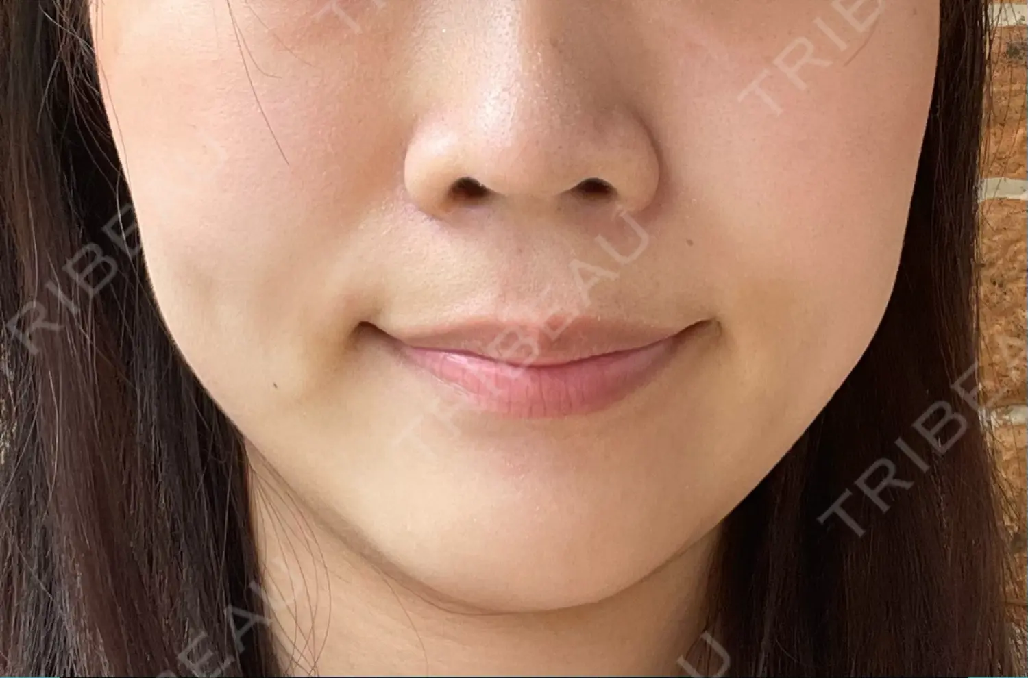 施術前の写真