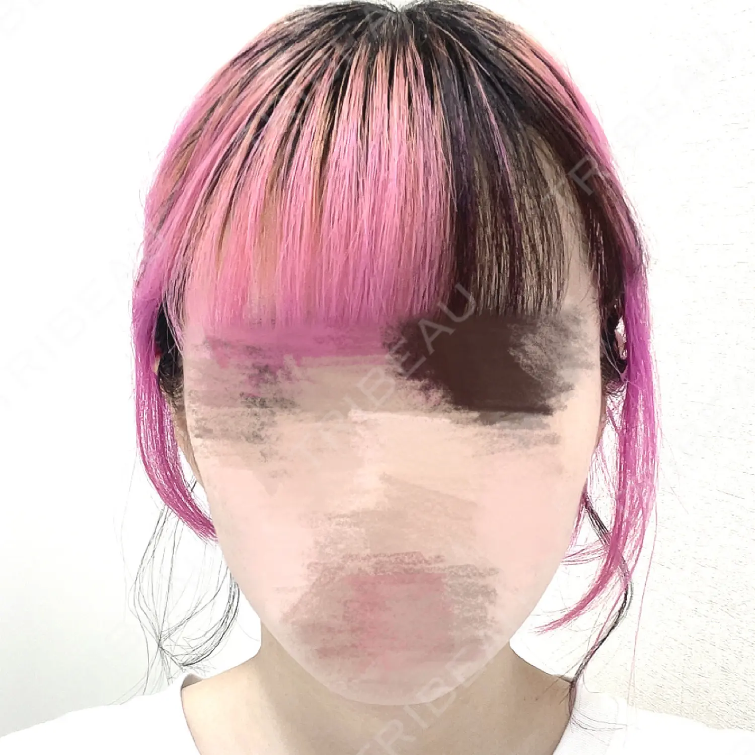 施術前の写真