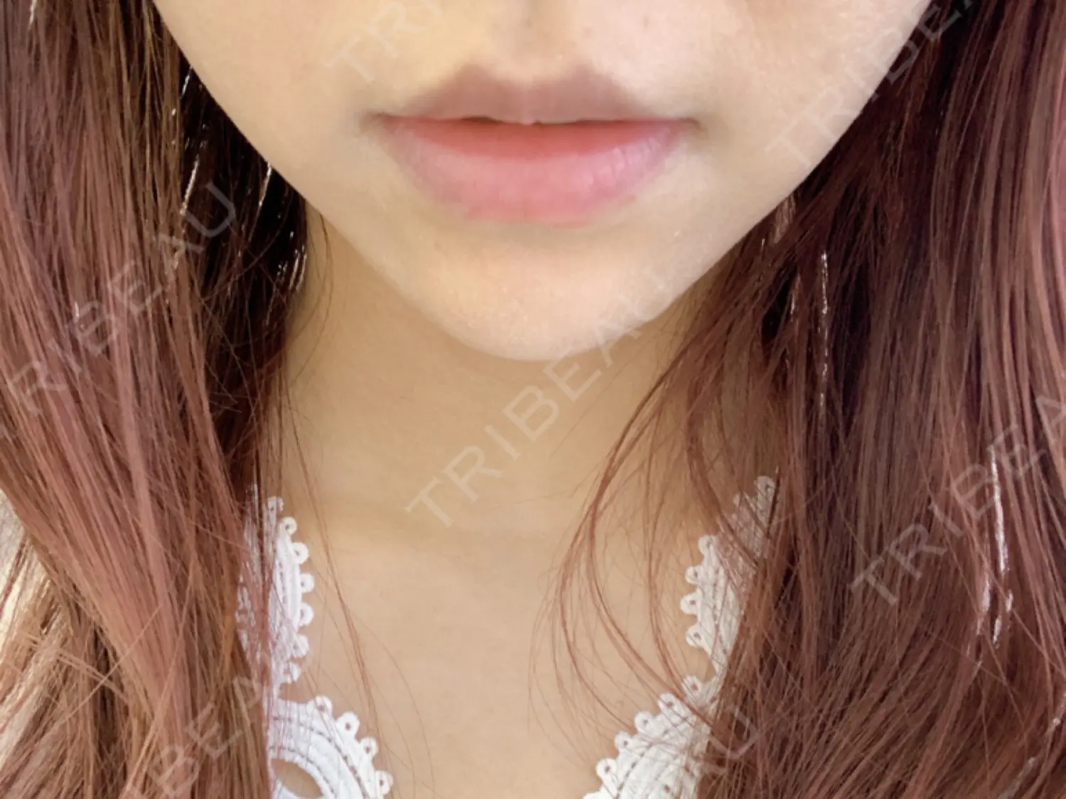 施術前の写真