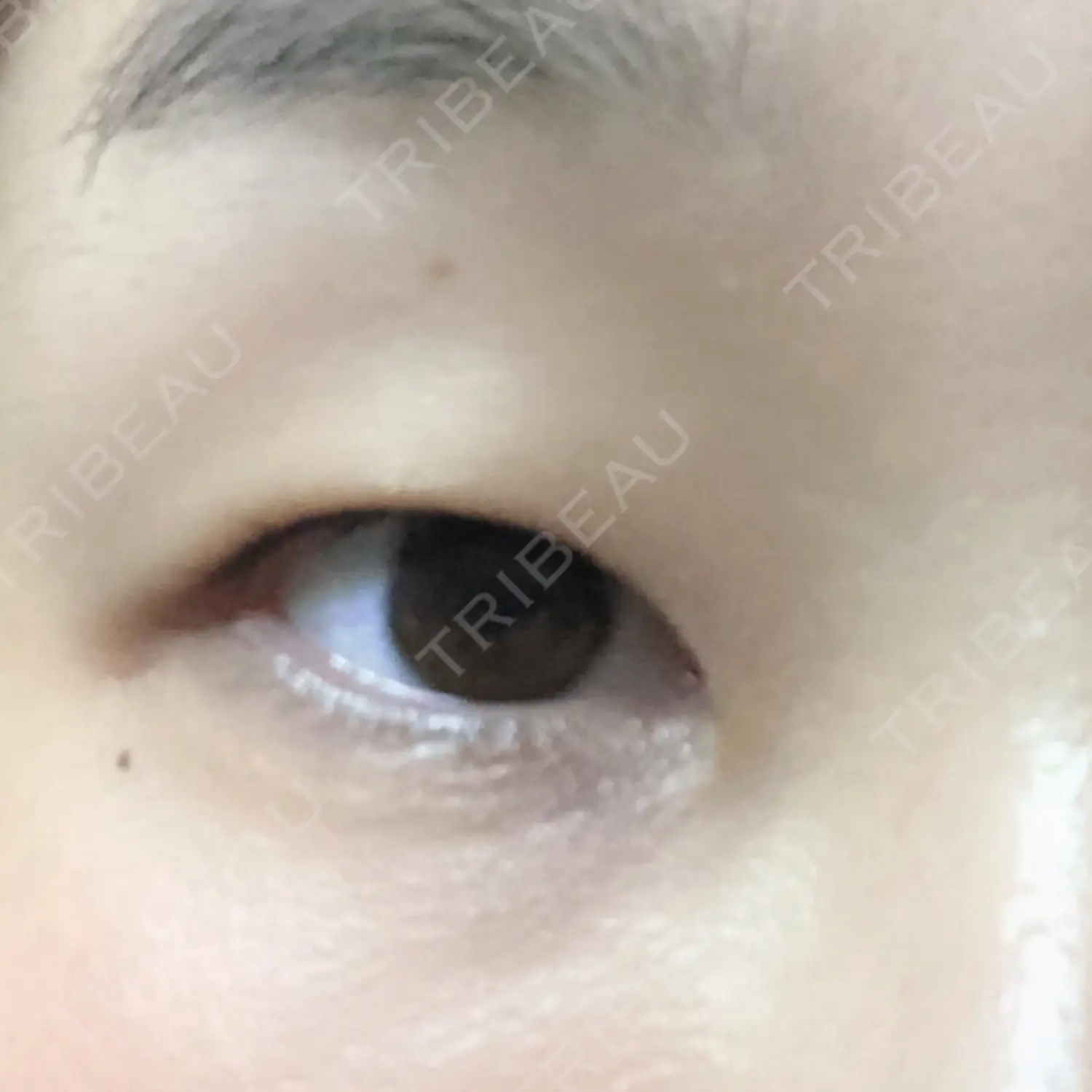施術前の写真