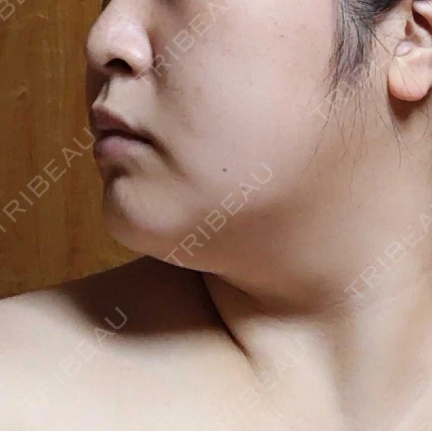 施術前の写真