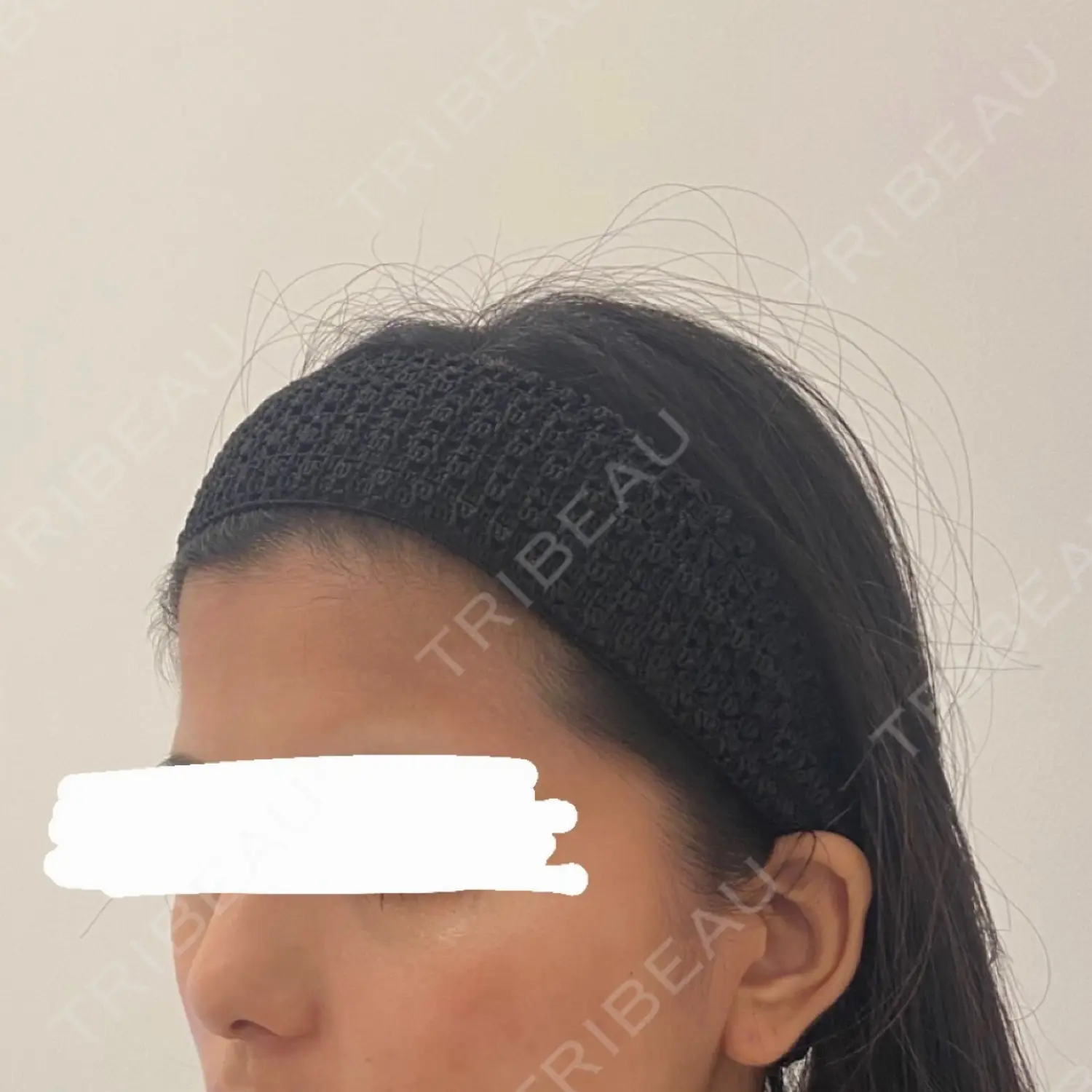 施術前の写真