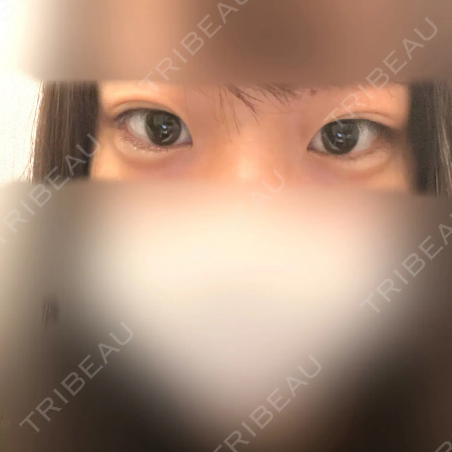施術前の写真
