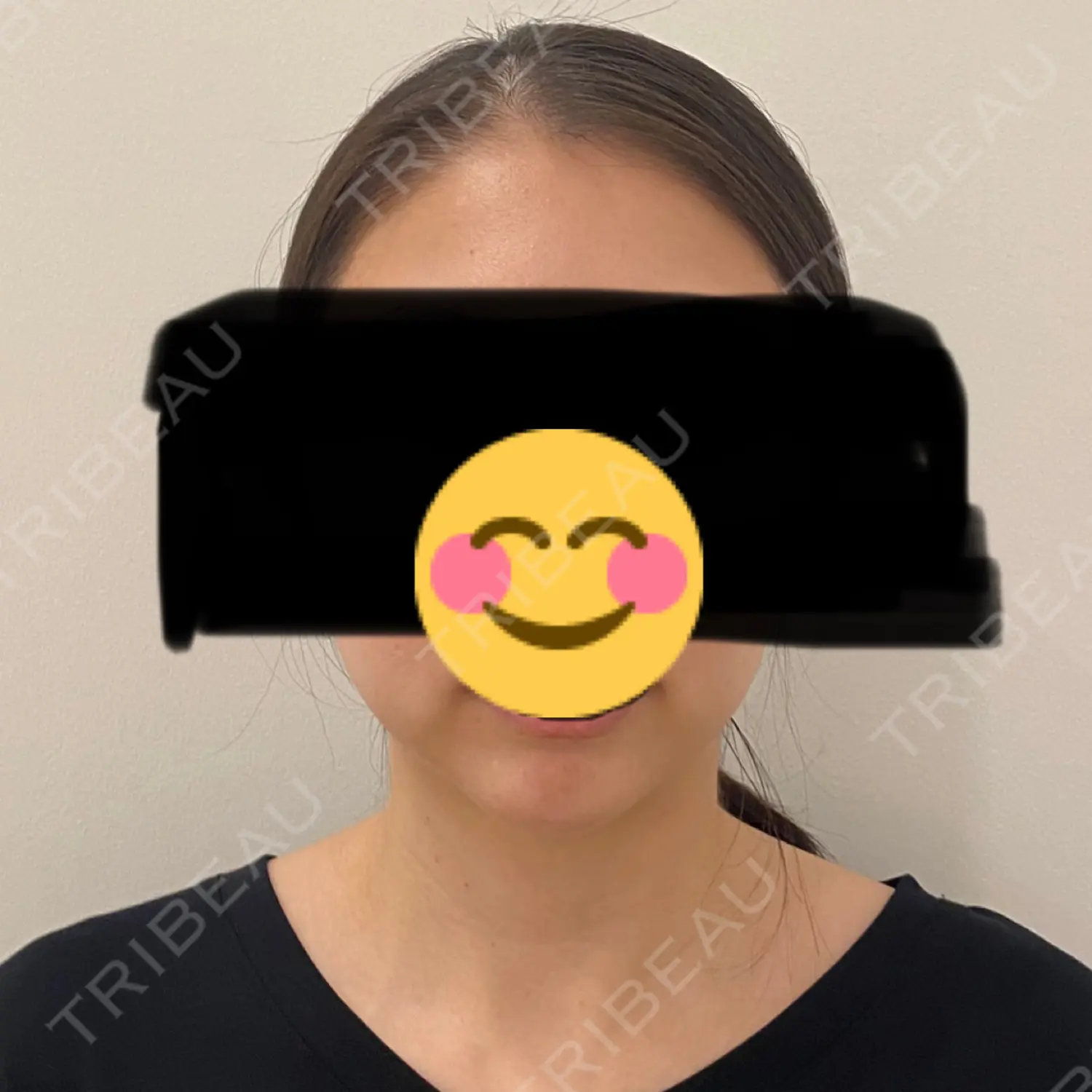 施術前の写真