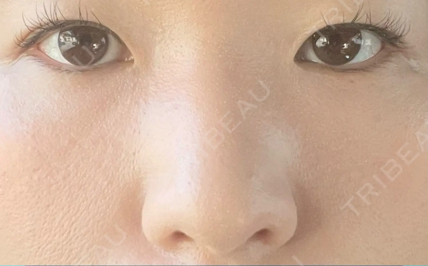 施術前の写真