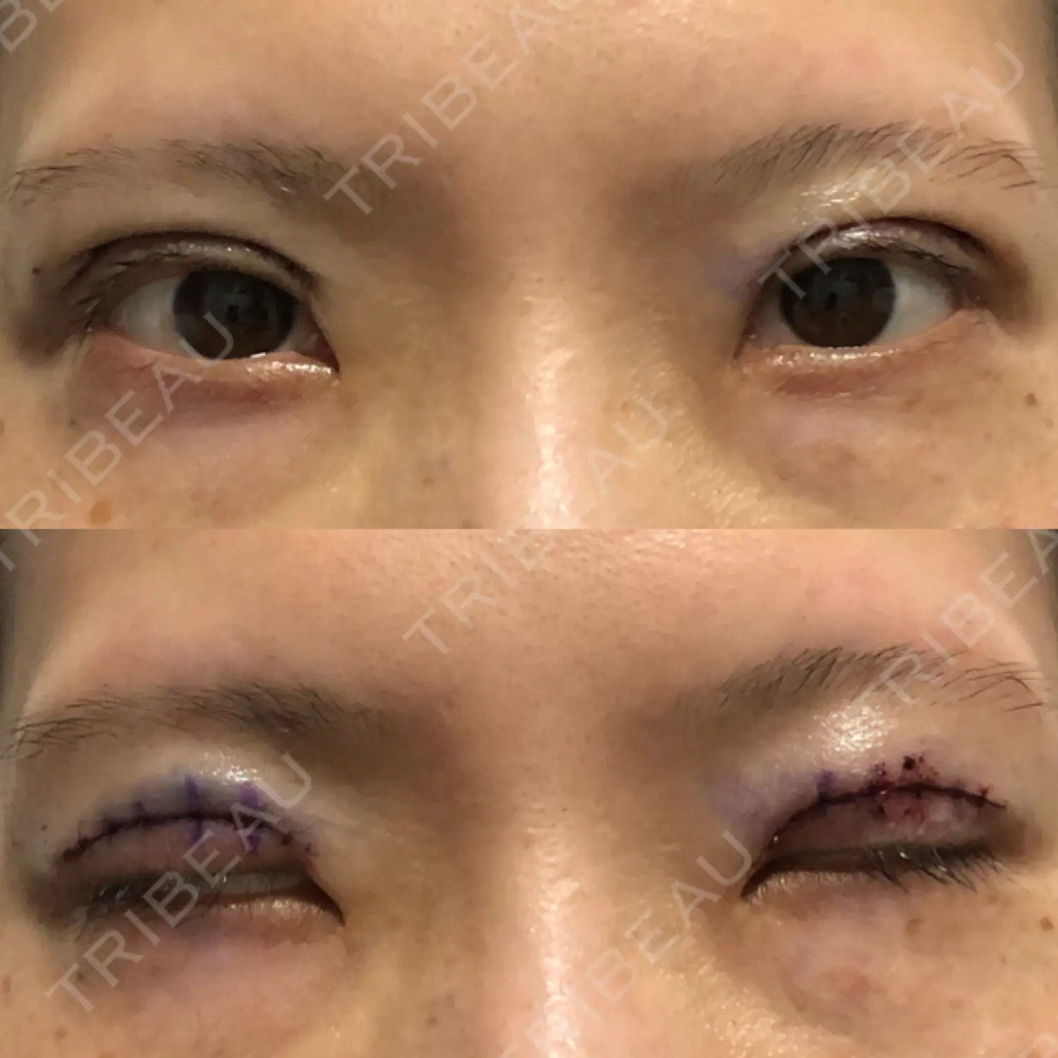 施術前の写真