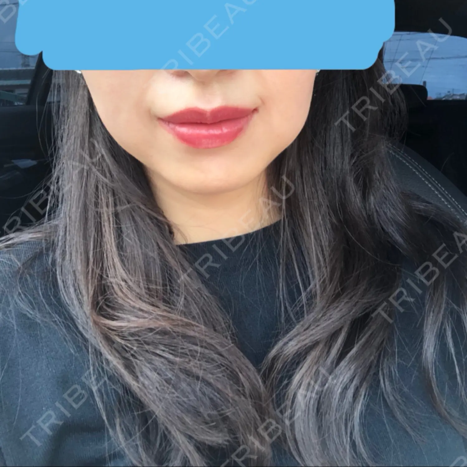 施術前の写真