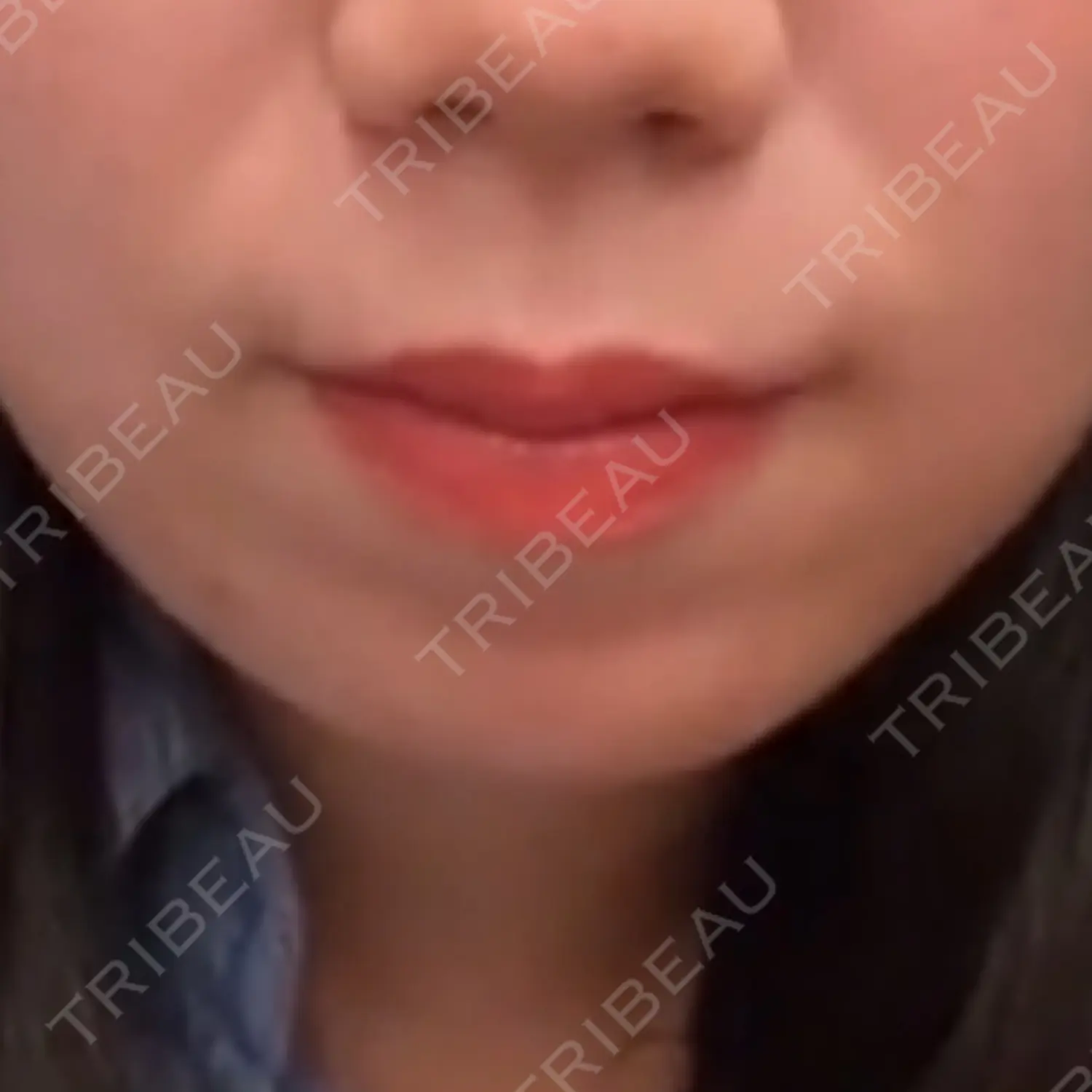 施術前の写真