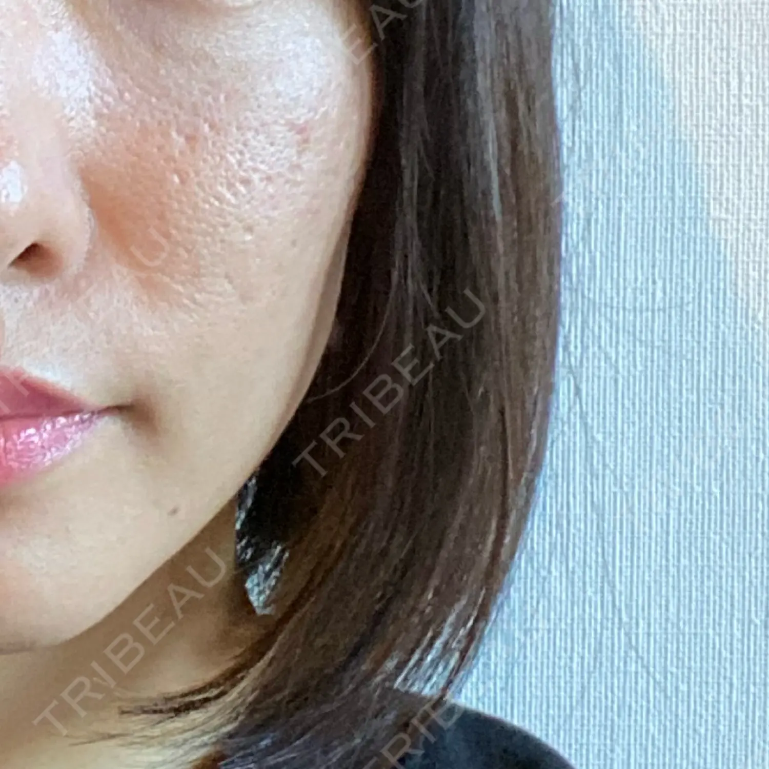 施術前の写真