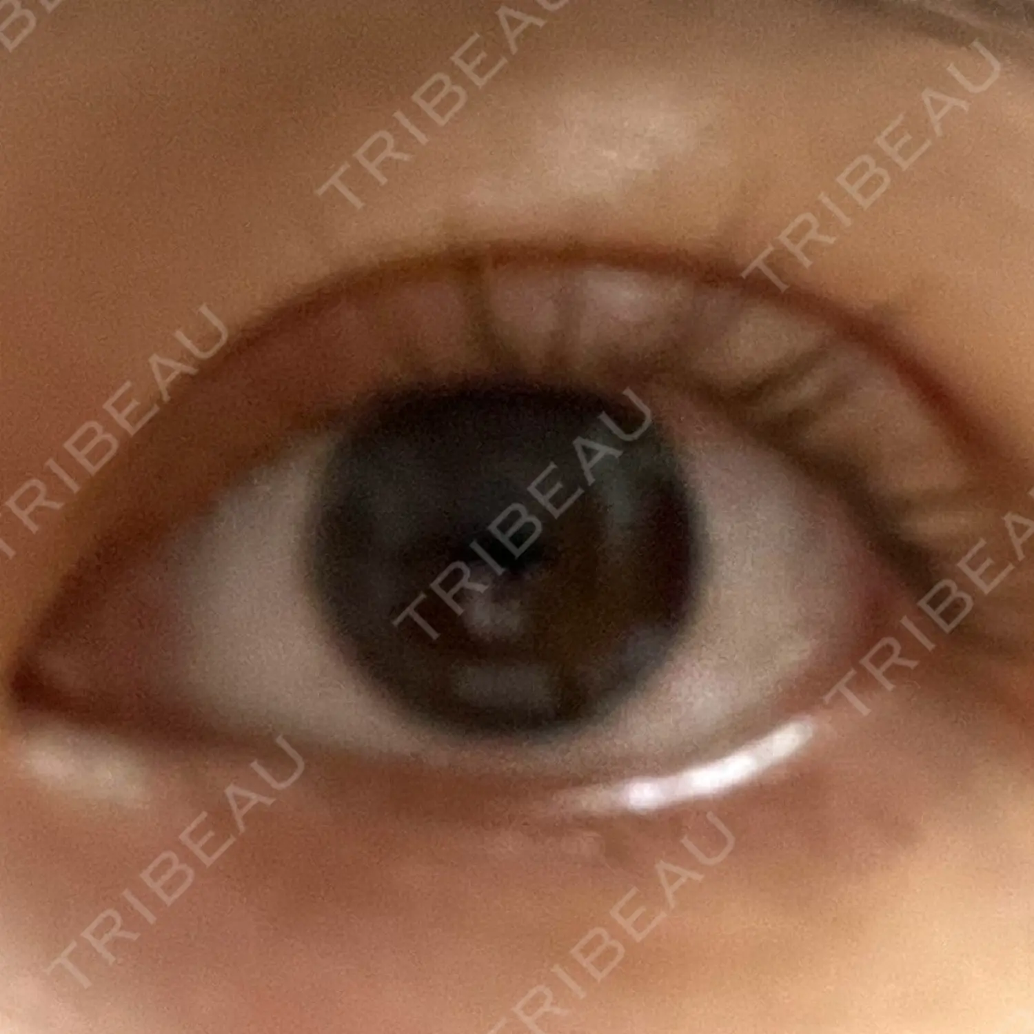 施術前の写真