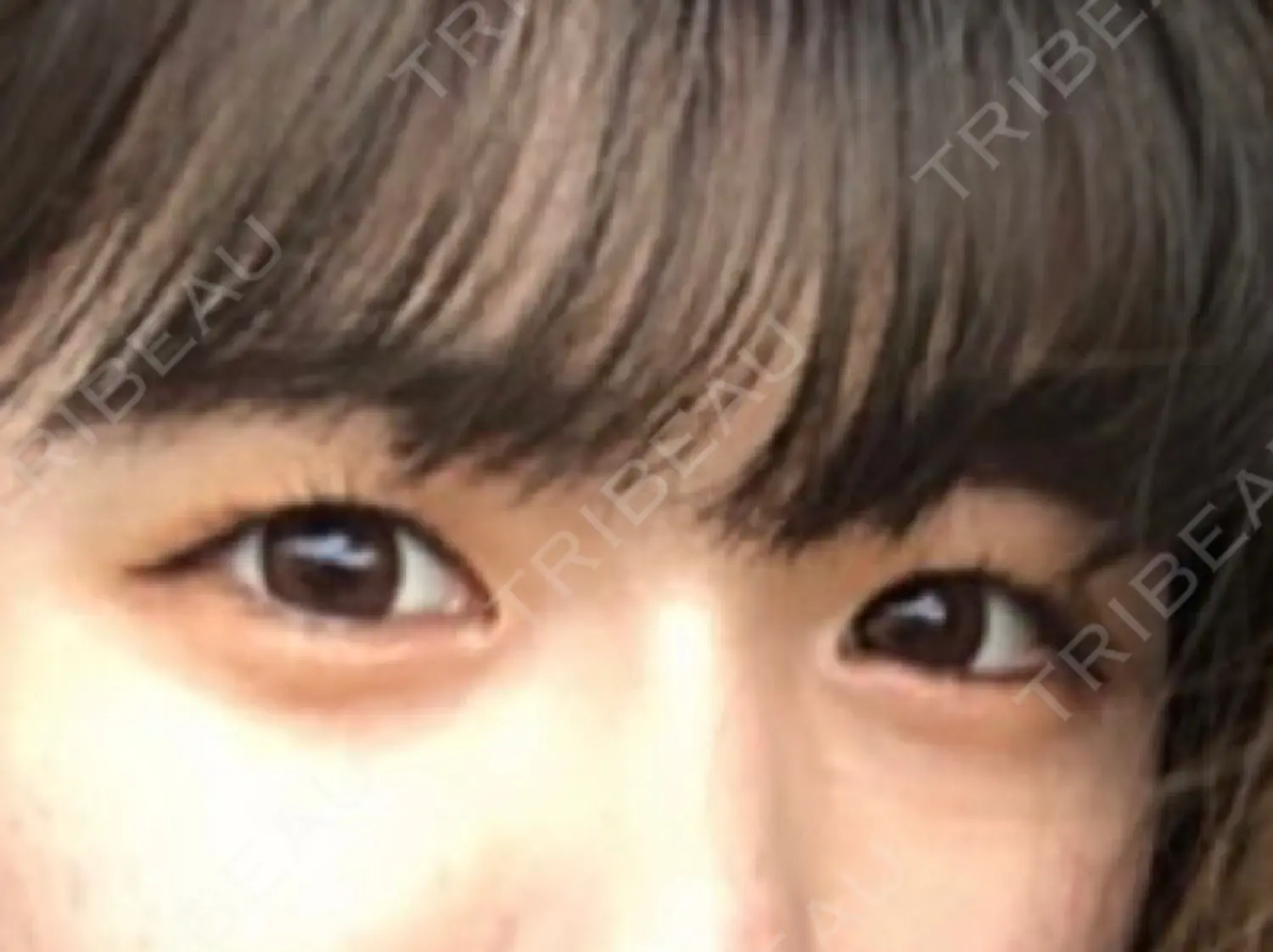 施術前の写真
