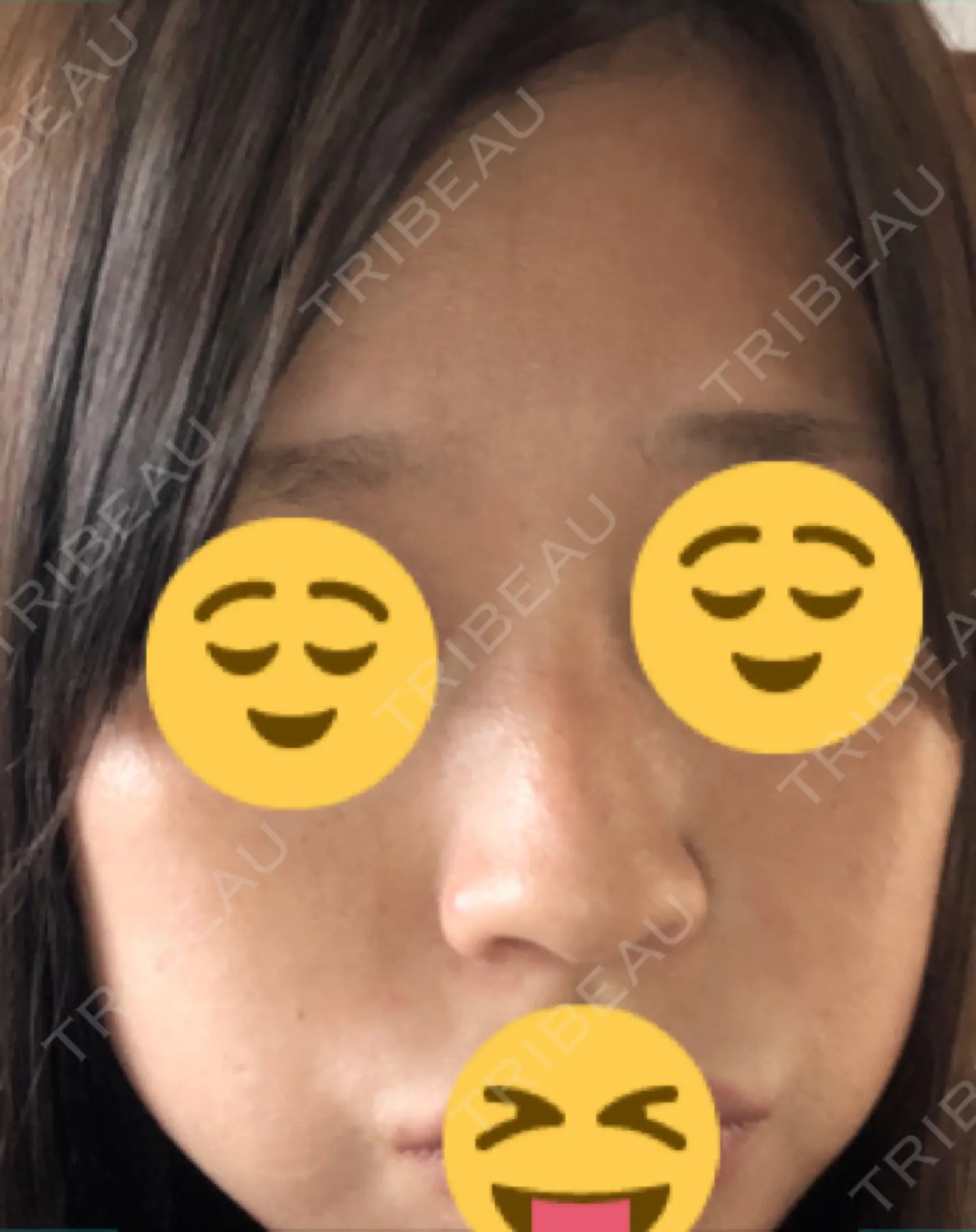 施術前の写真