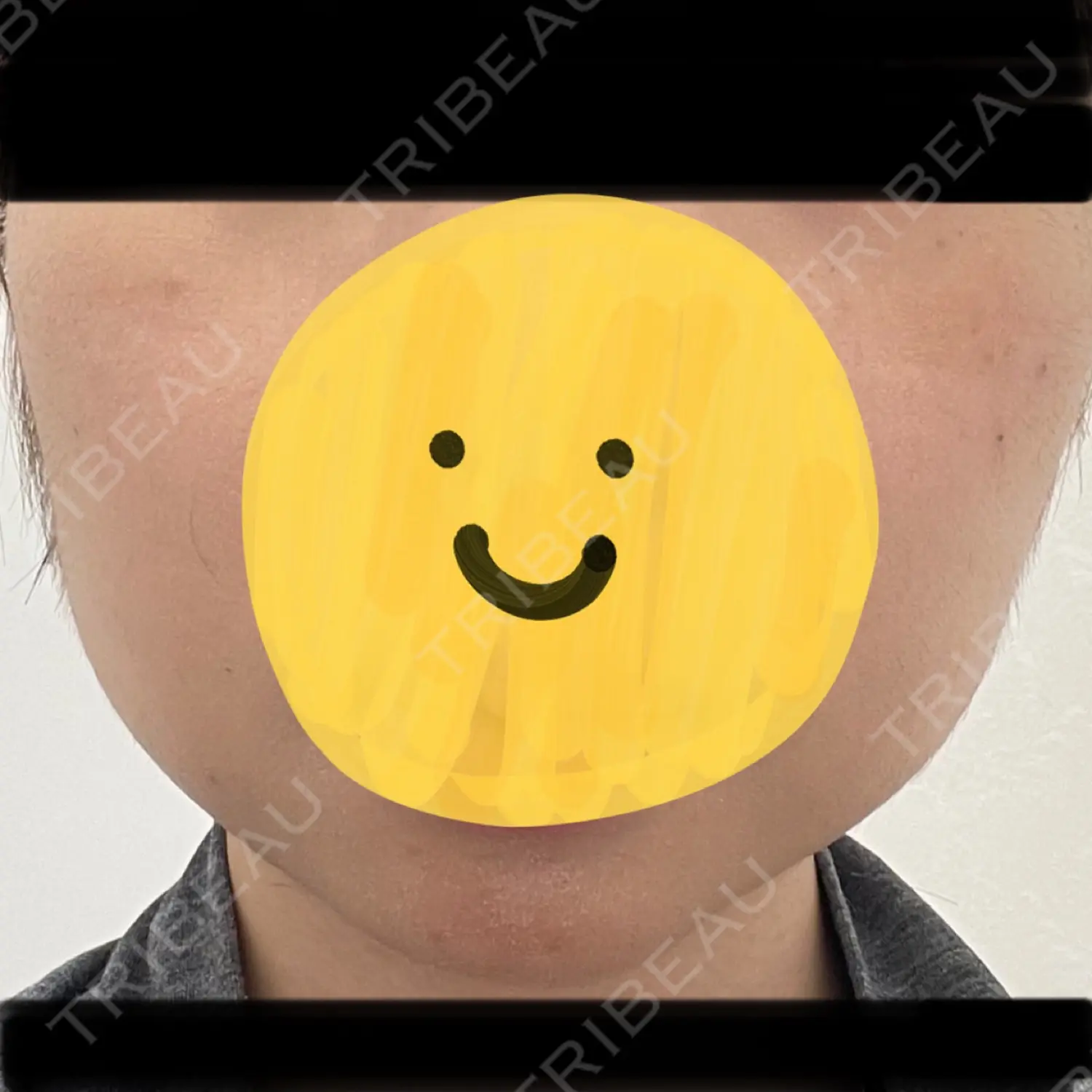 施術前の写真