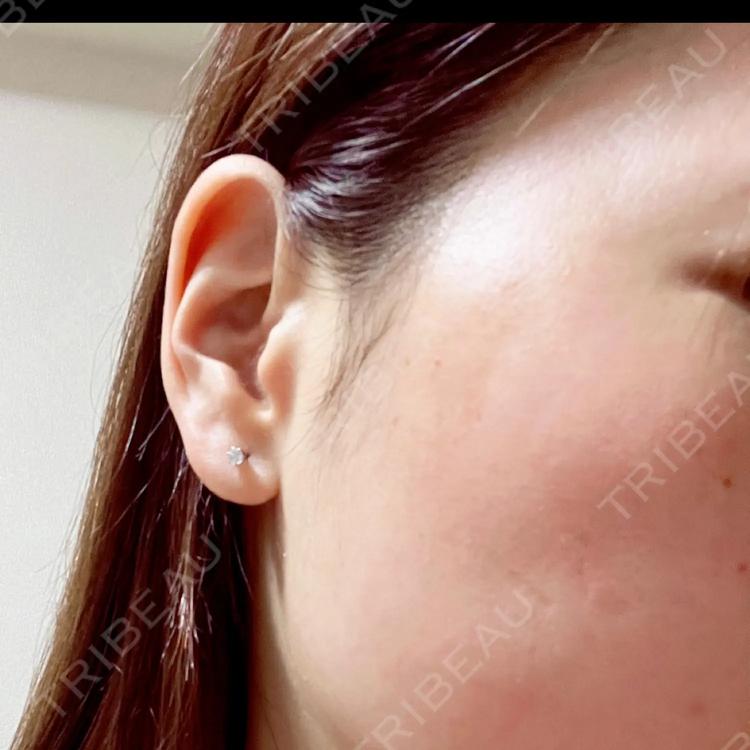 施術前の写真
