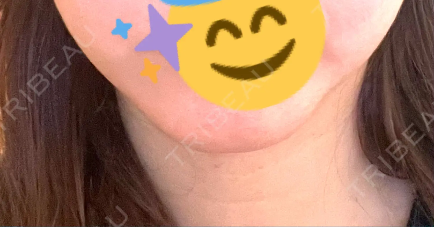 施術前の写真