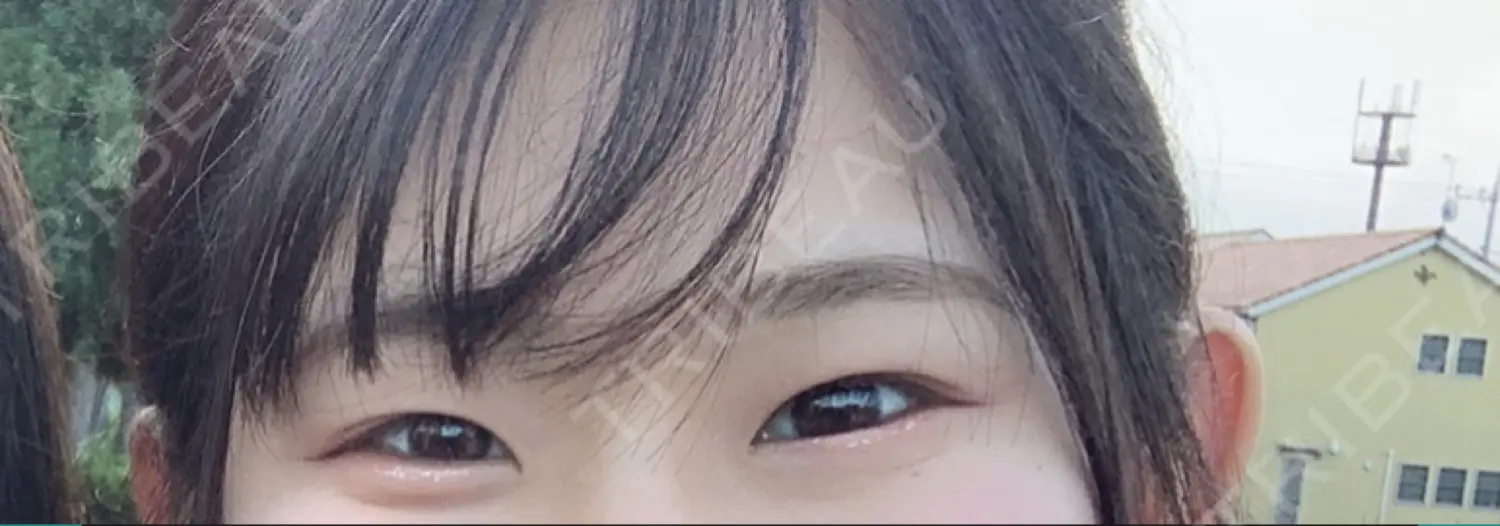 施術前の写真