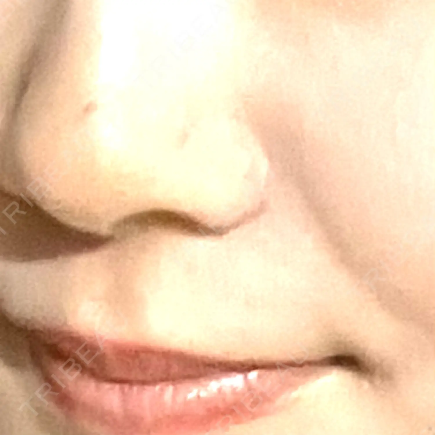 施術前の写真