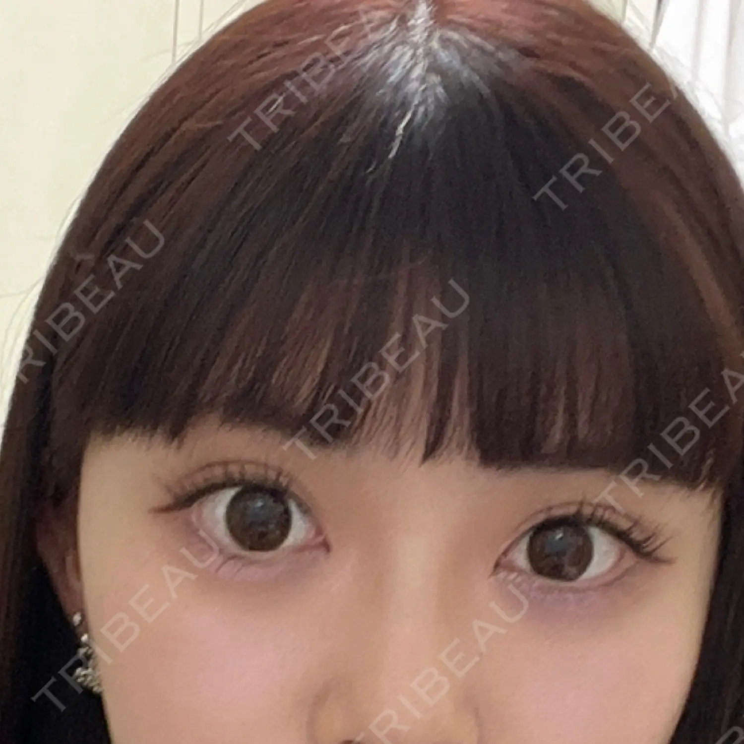 施術前の写真