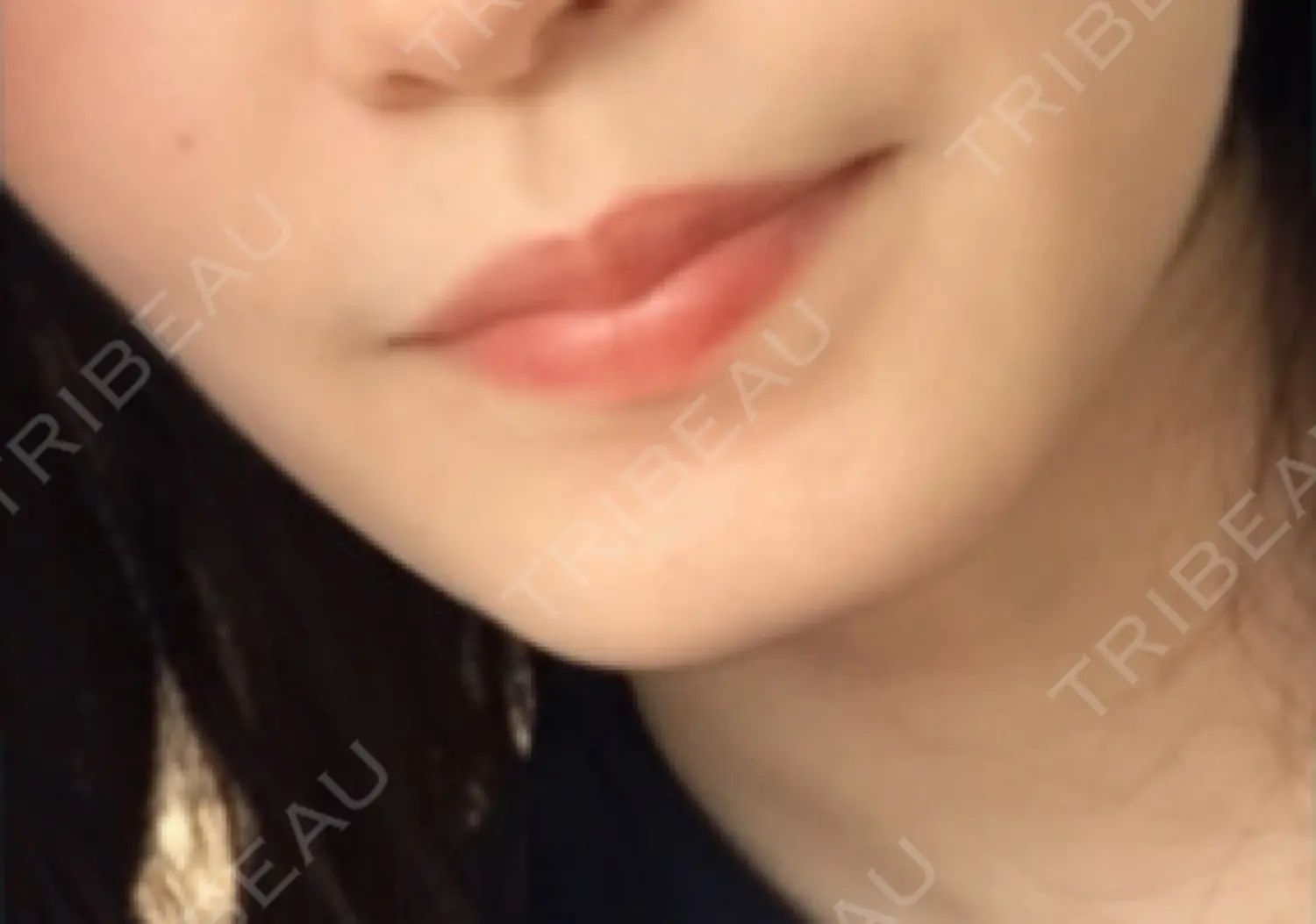 施術前の写真
