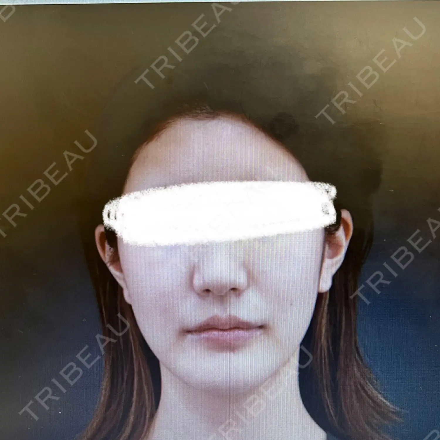 施術前の写真
