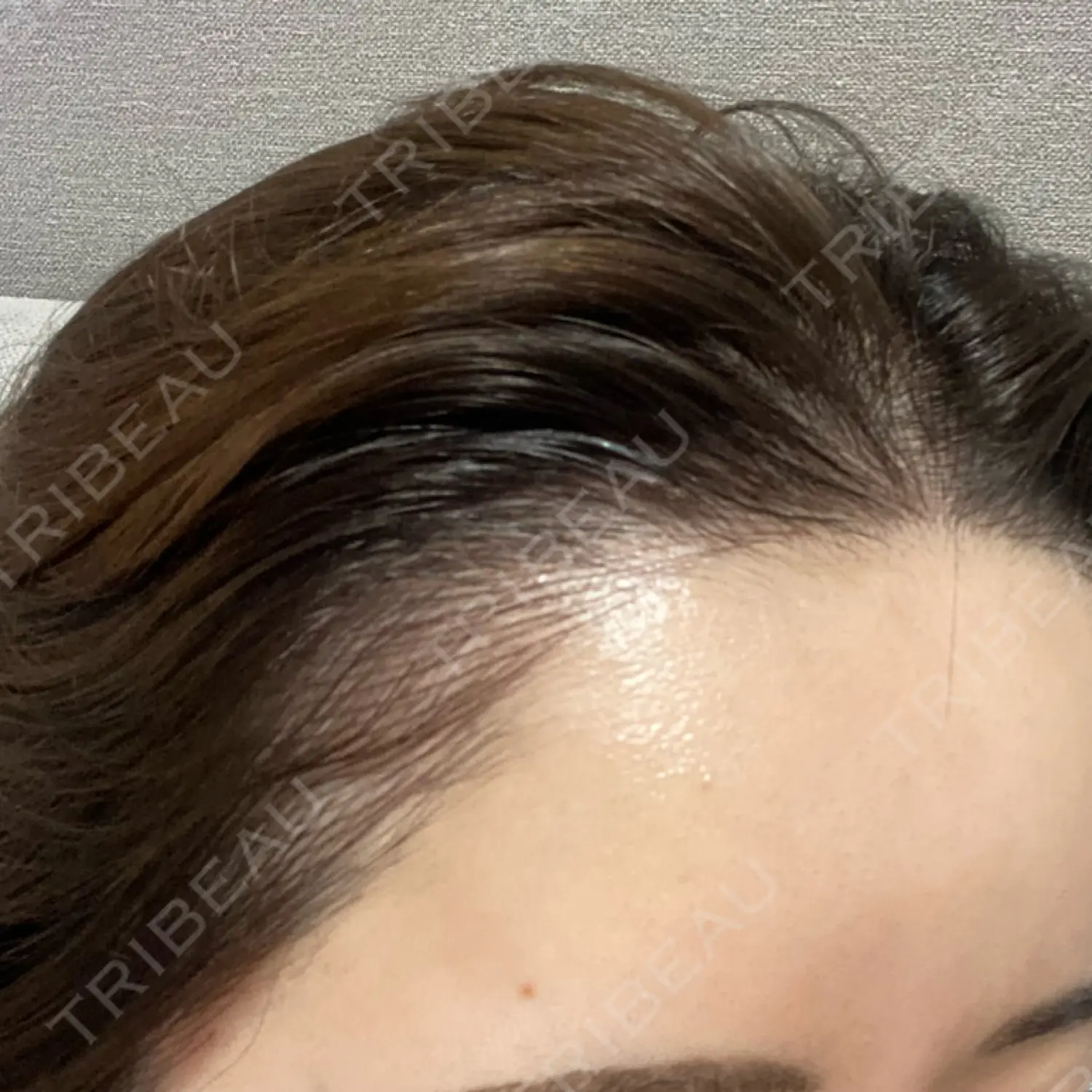 施術前の写真