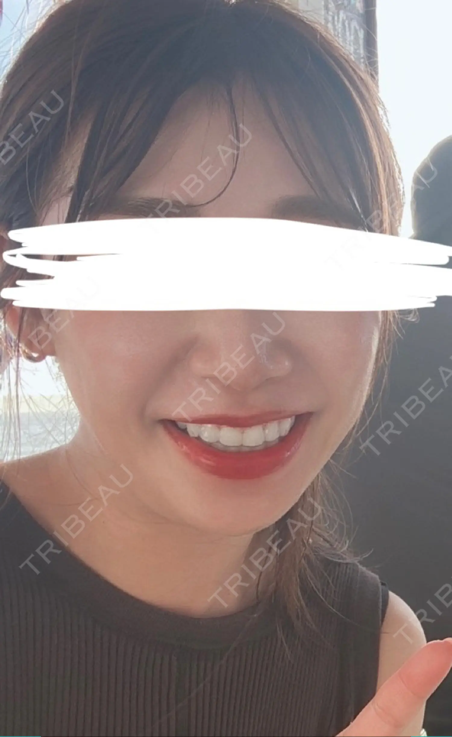 施術前の写真