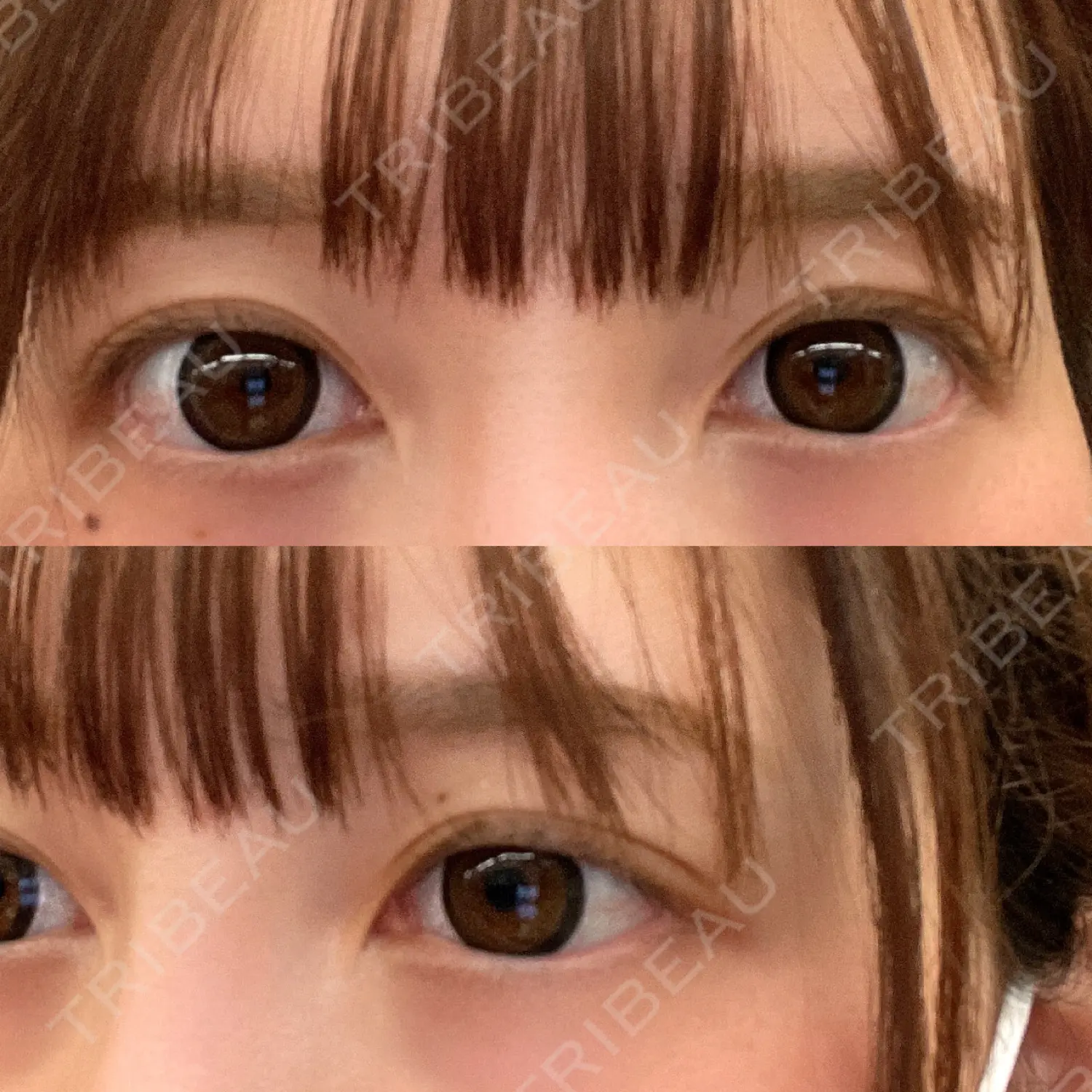 施術前の写真