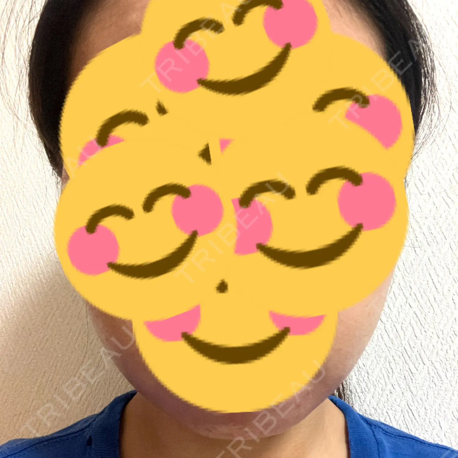 施術前の写真