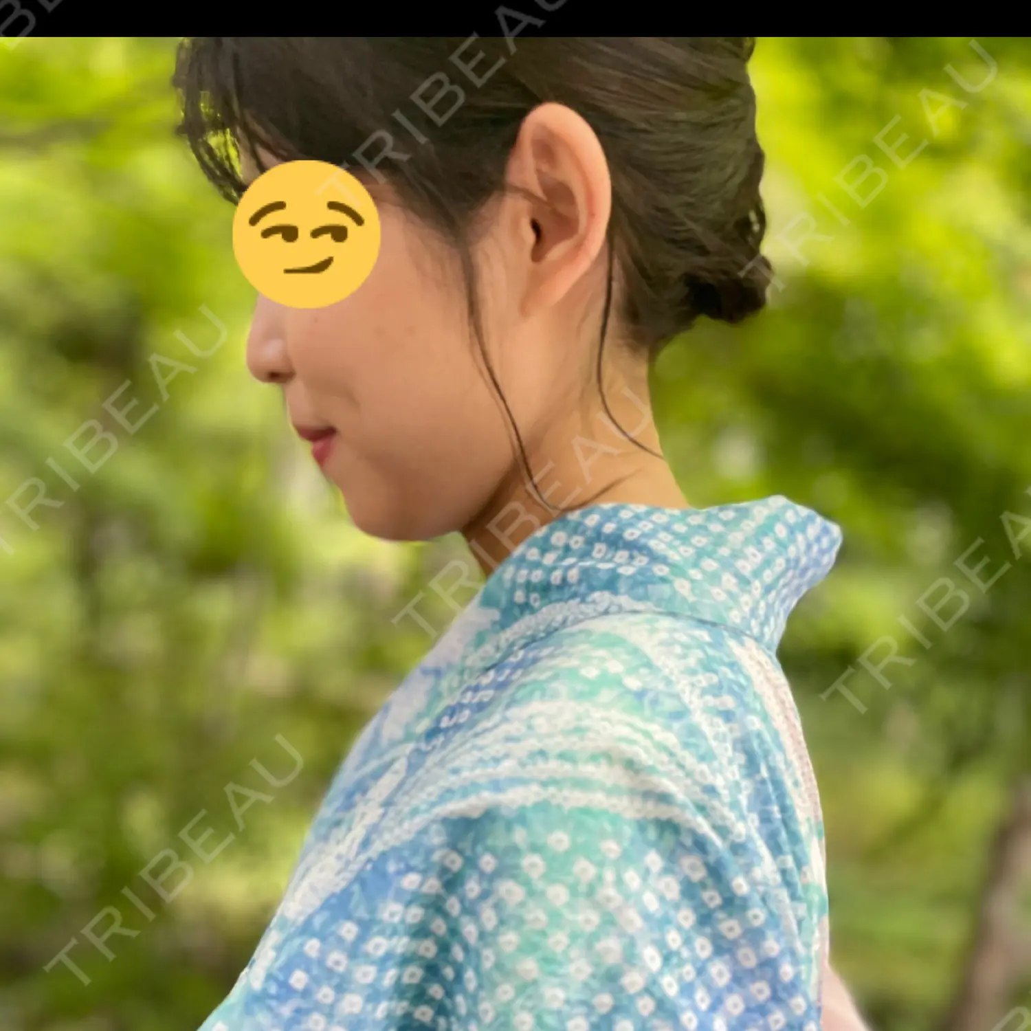 施術前の写真