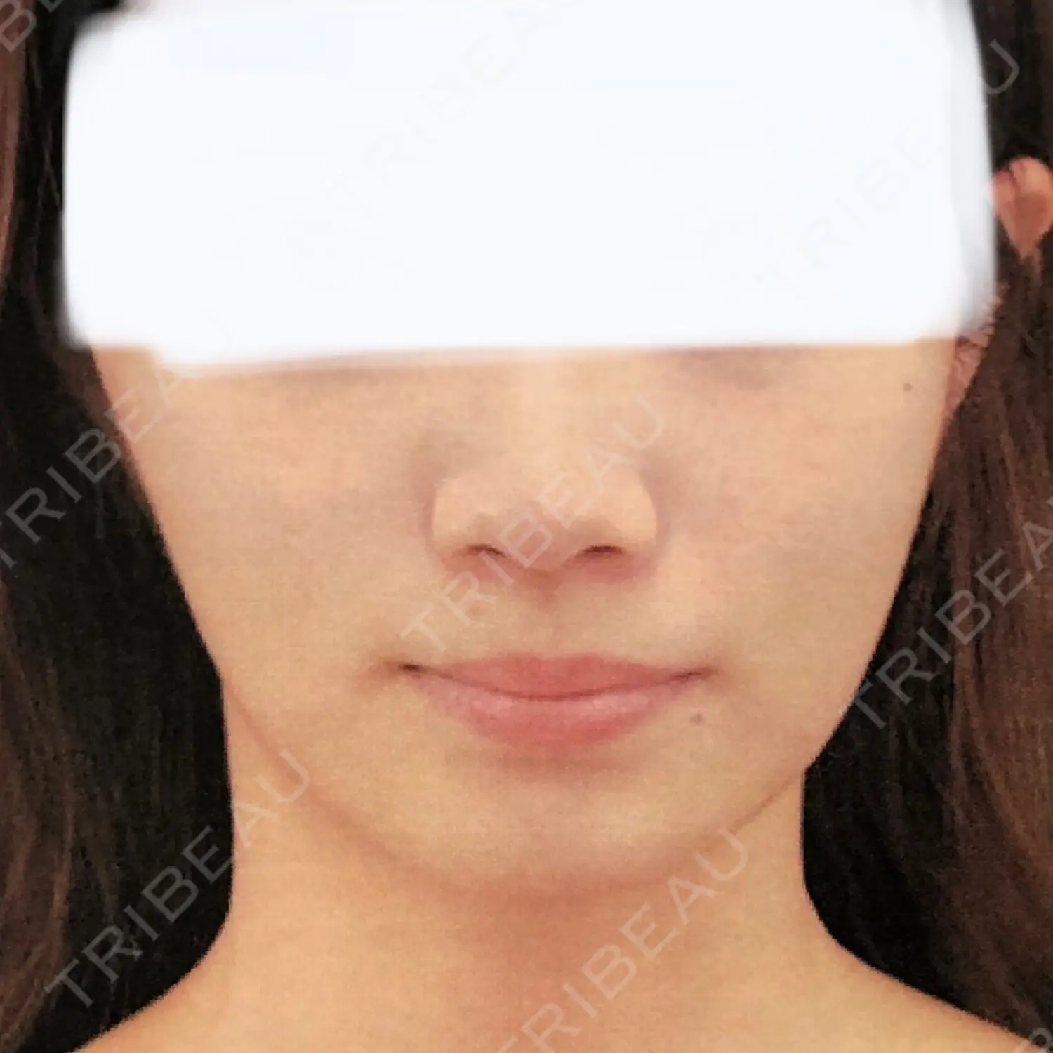 施術前の写真
