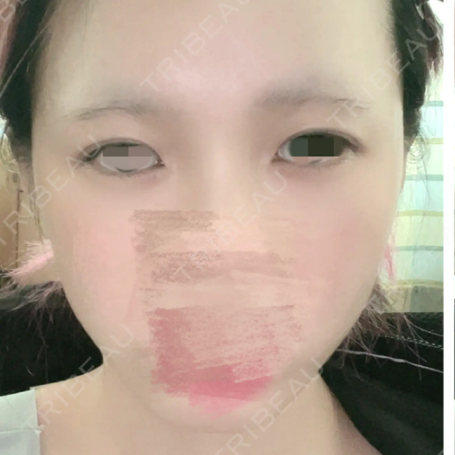 施術前の写真